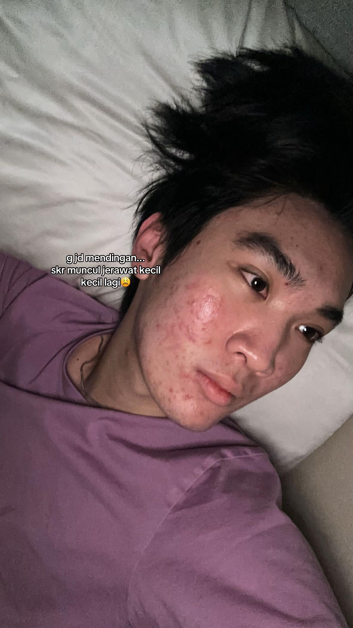 @Mau kulit sehat