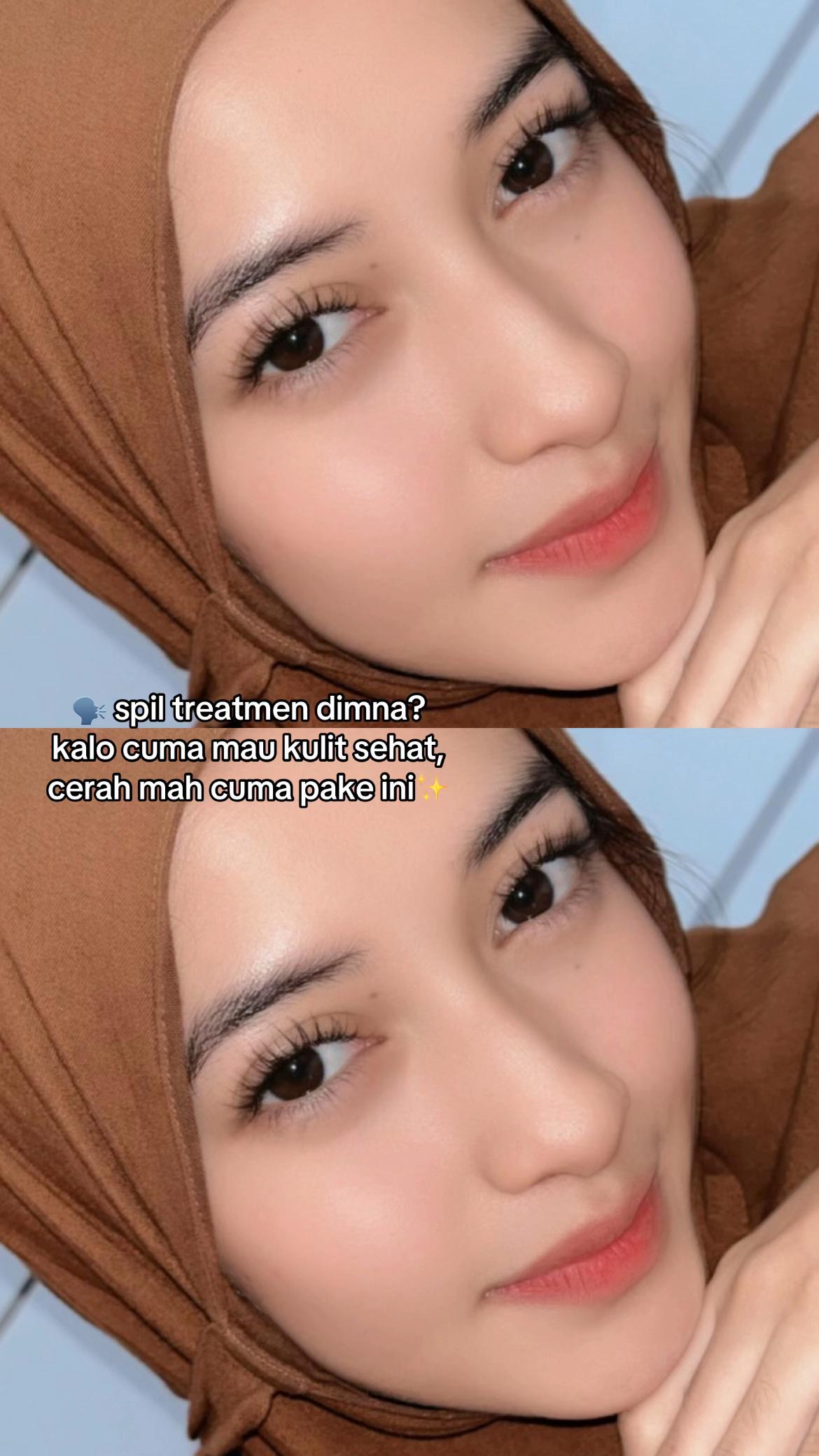 @Cipi🦴