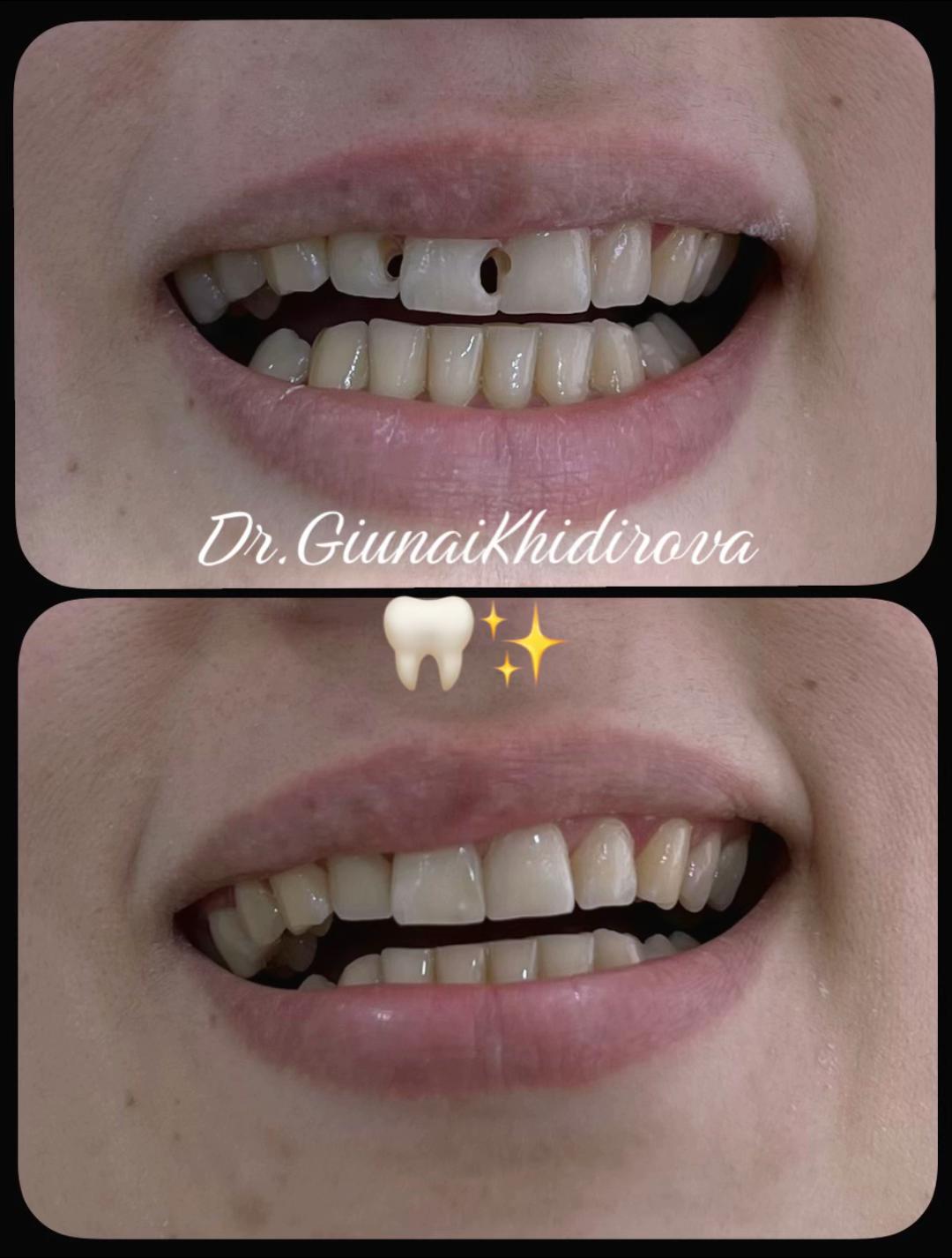 @Dr.Гюнай