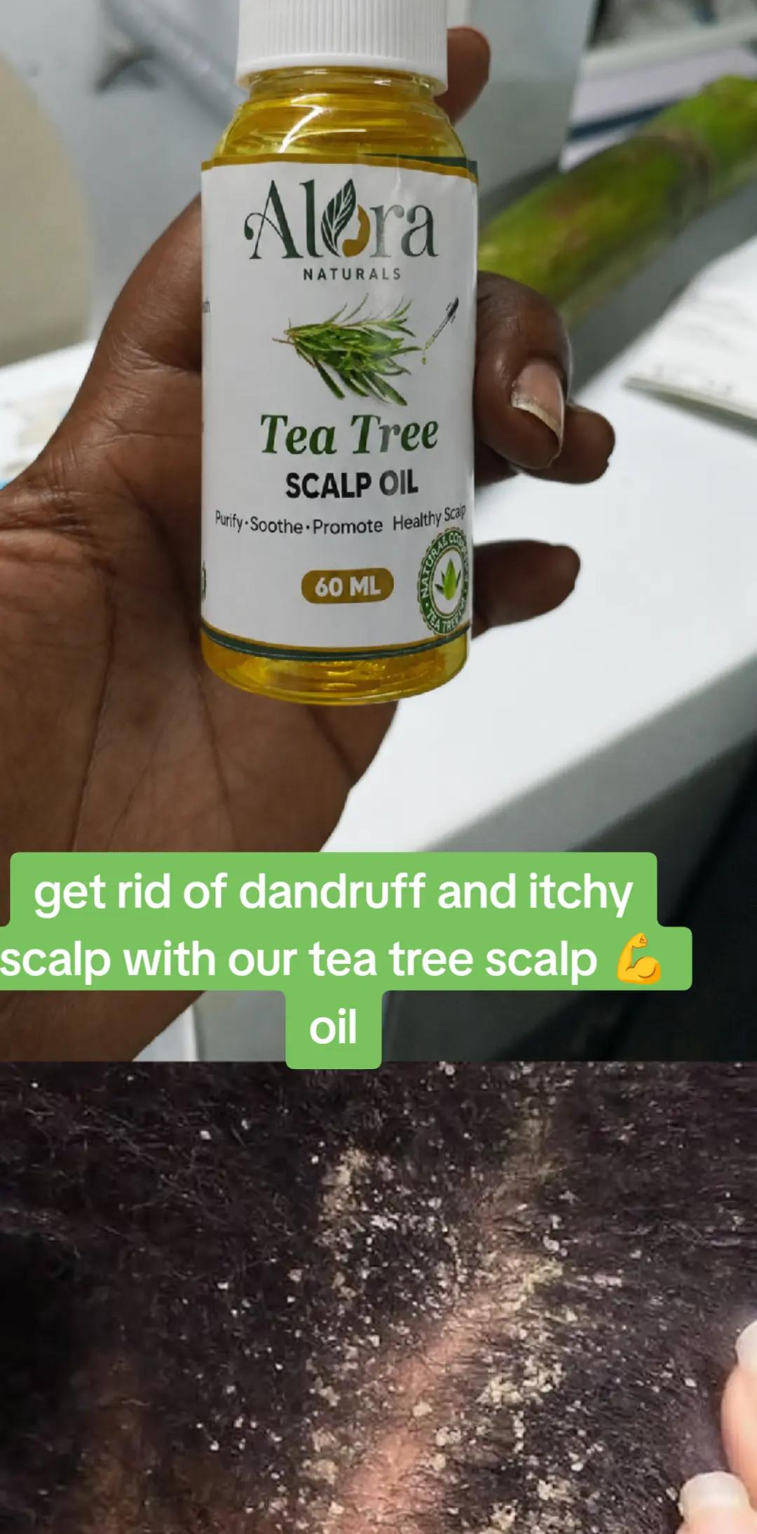 @Alora naturals