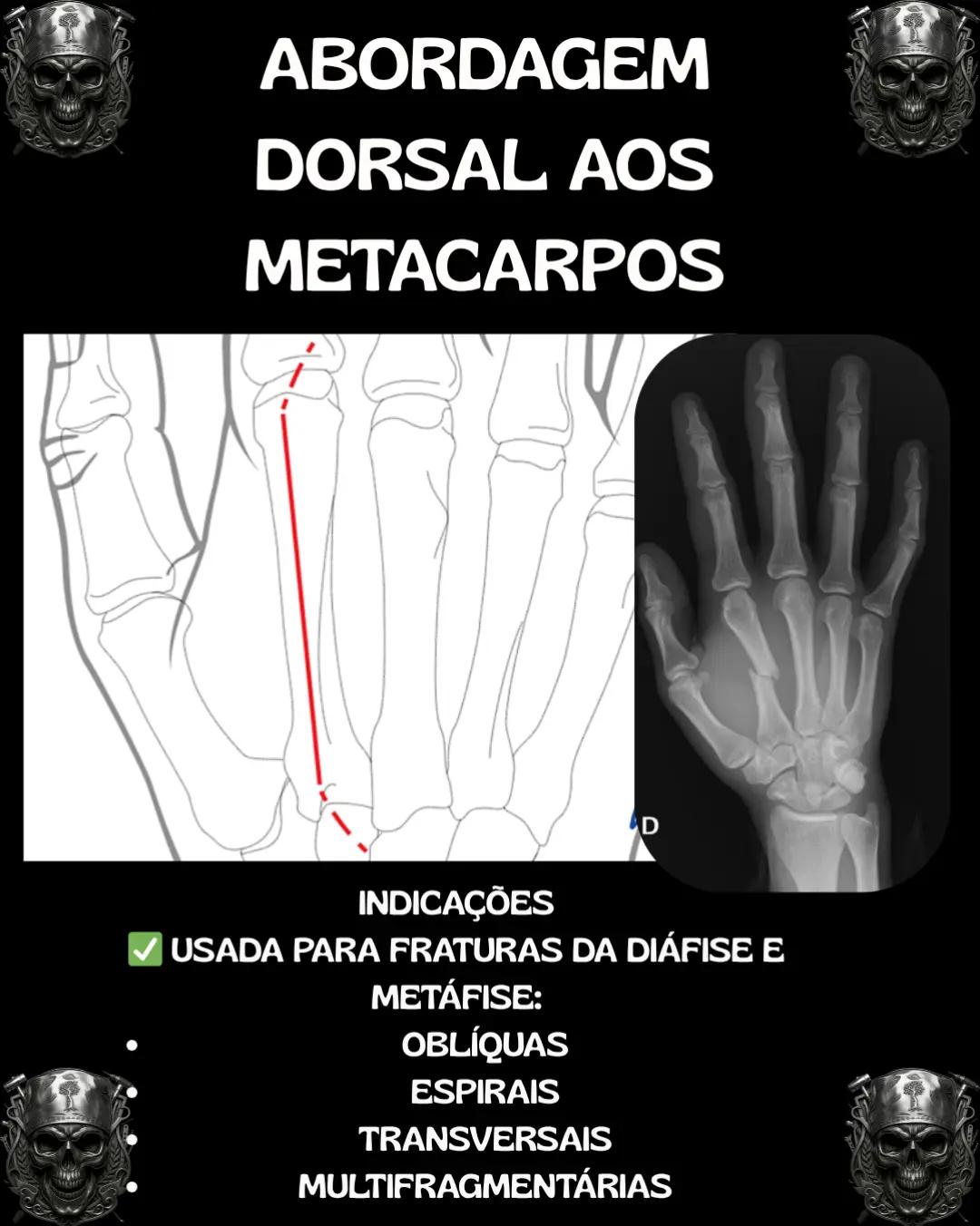 @Traumatologia Maluca