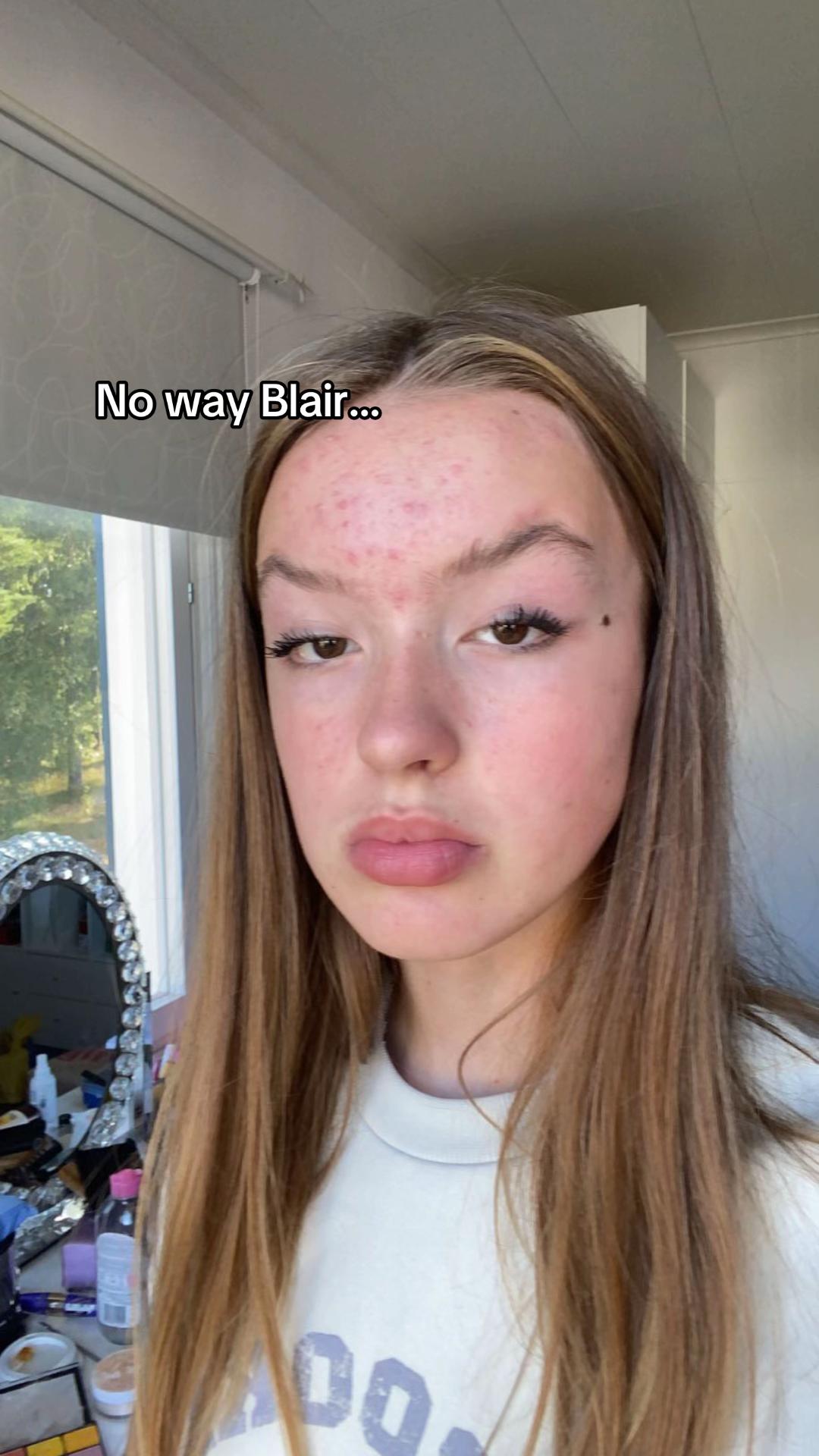 @Ella