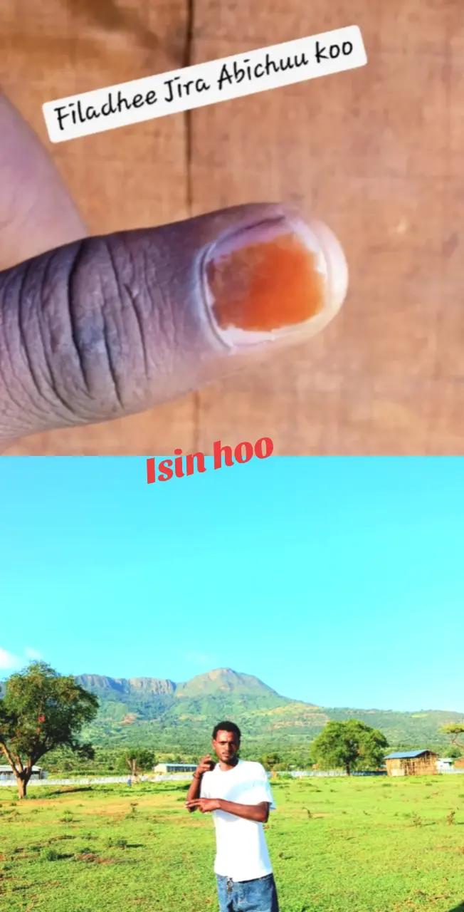 @Mr♤Garuu🦋