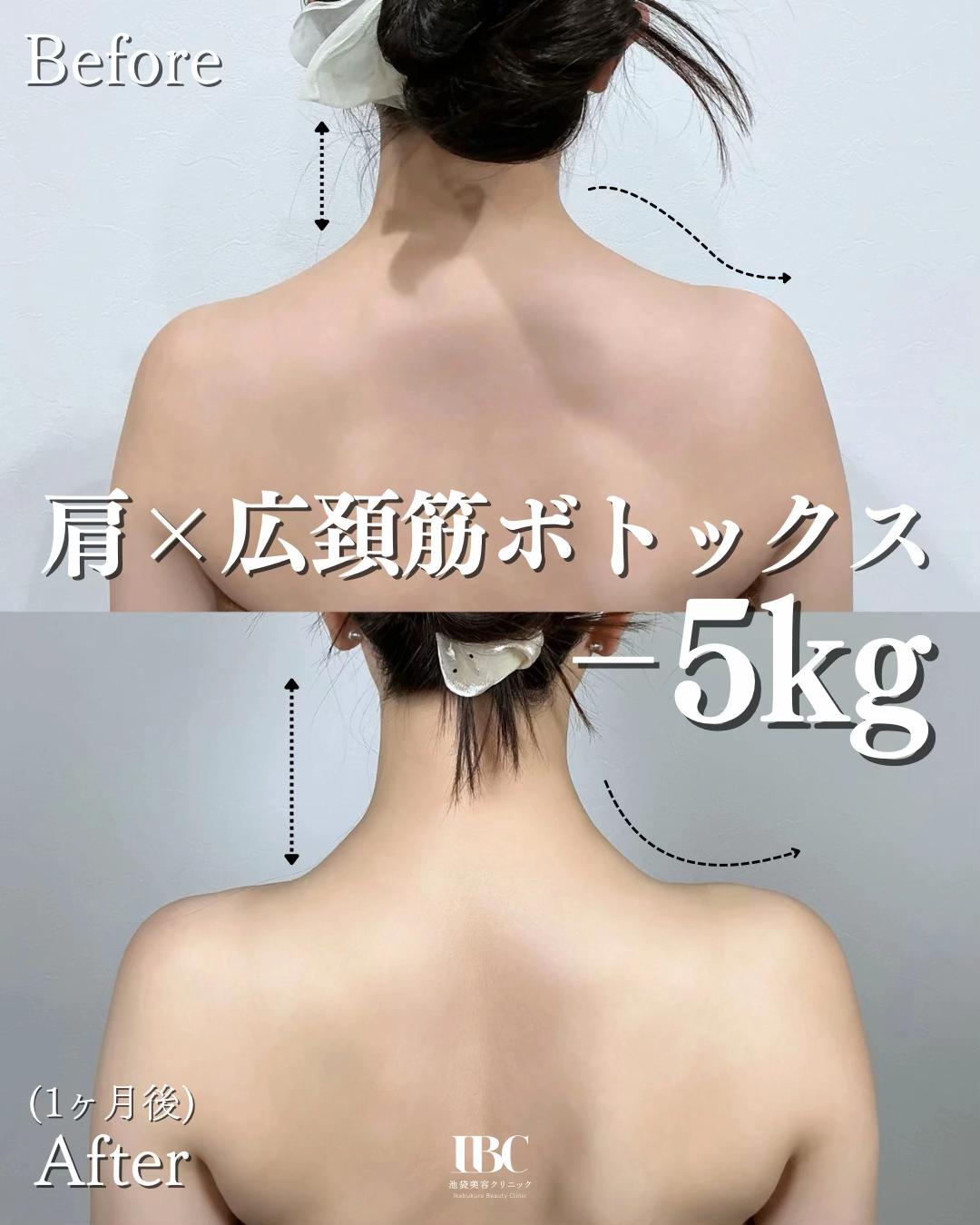 @高倉光平【タレ目形成×目尻切開】