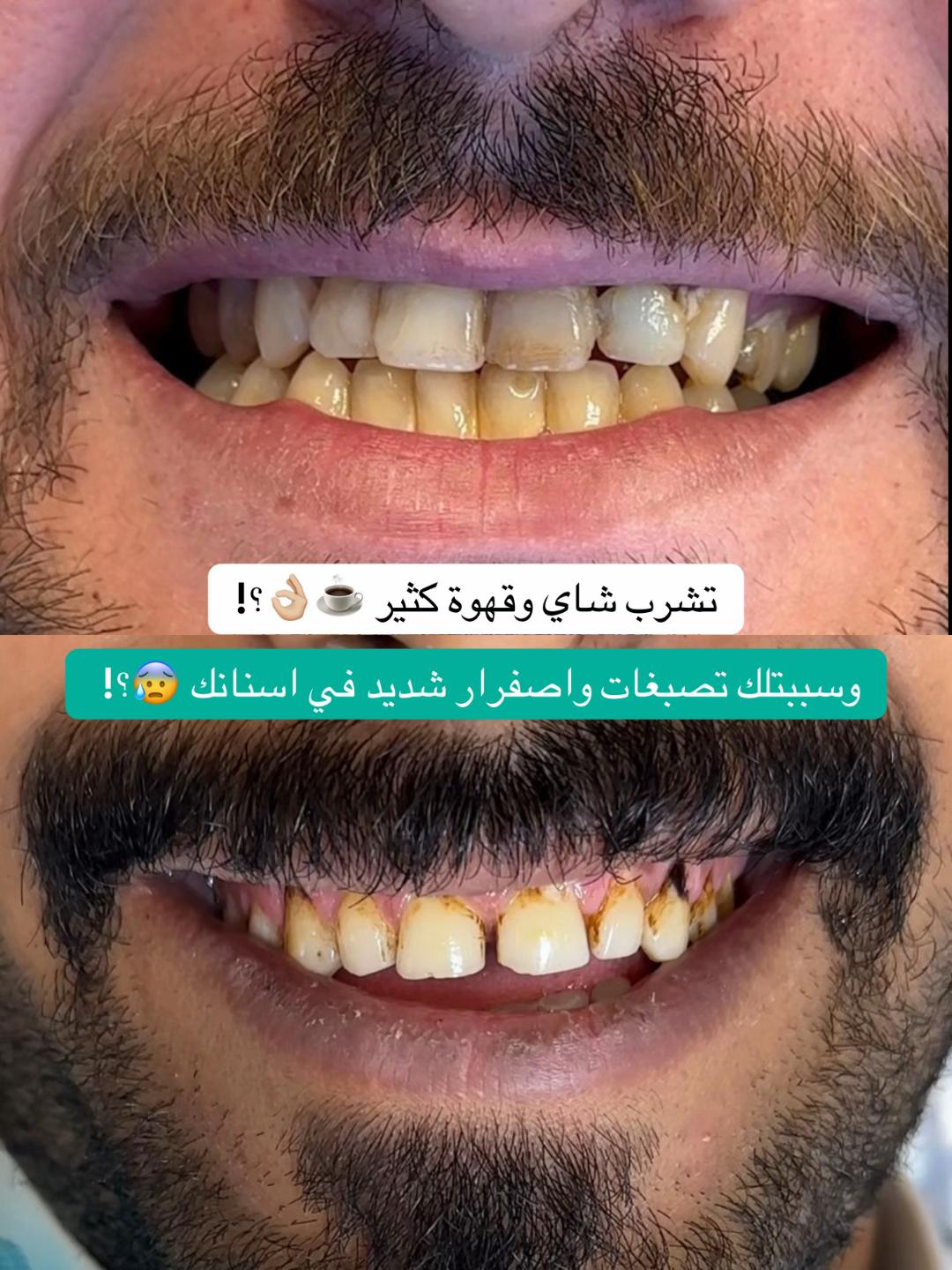 @Dr.lina_almasmoum