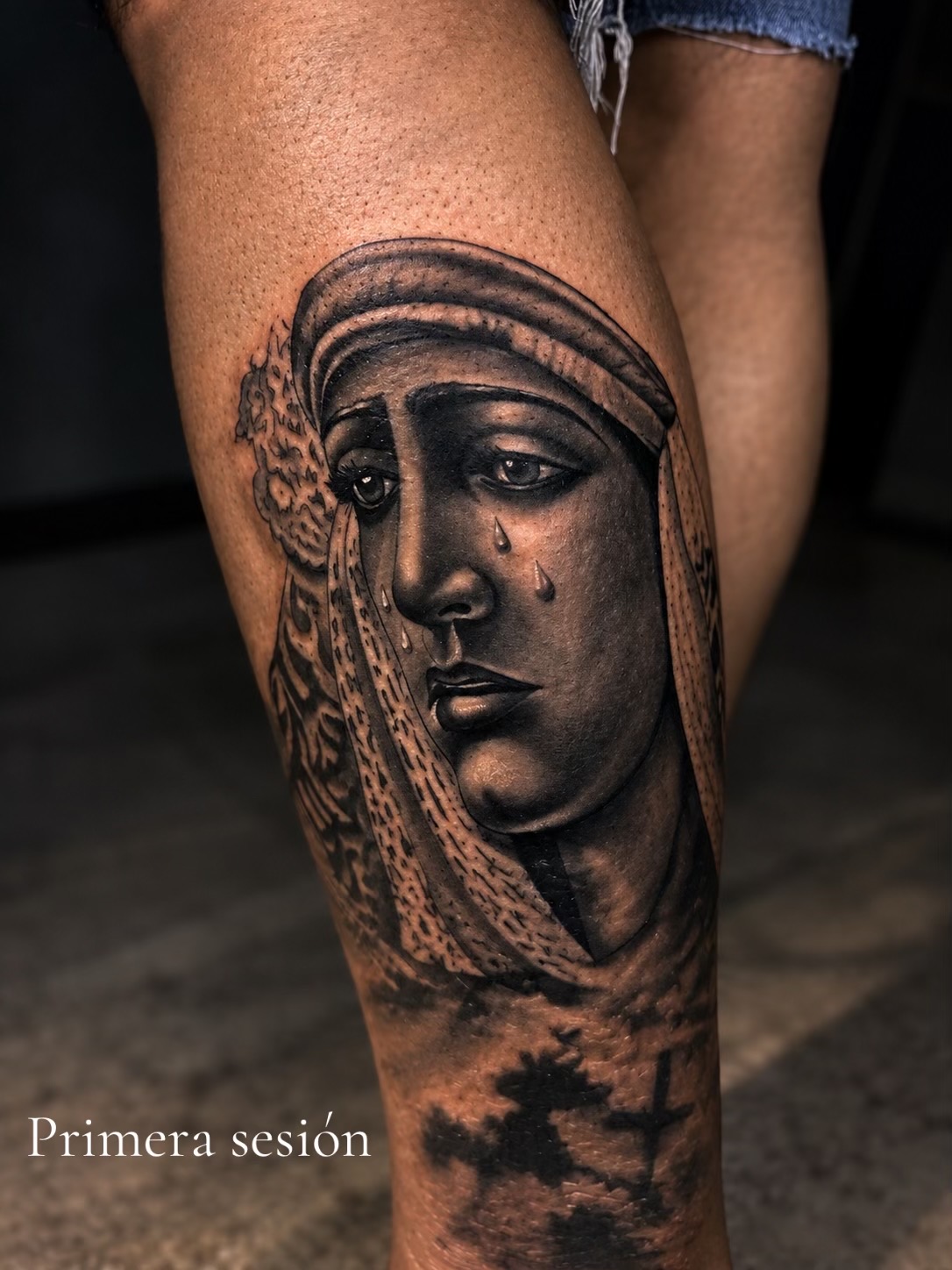 @Tattoo_Surgeon_