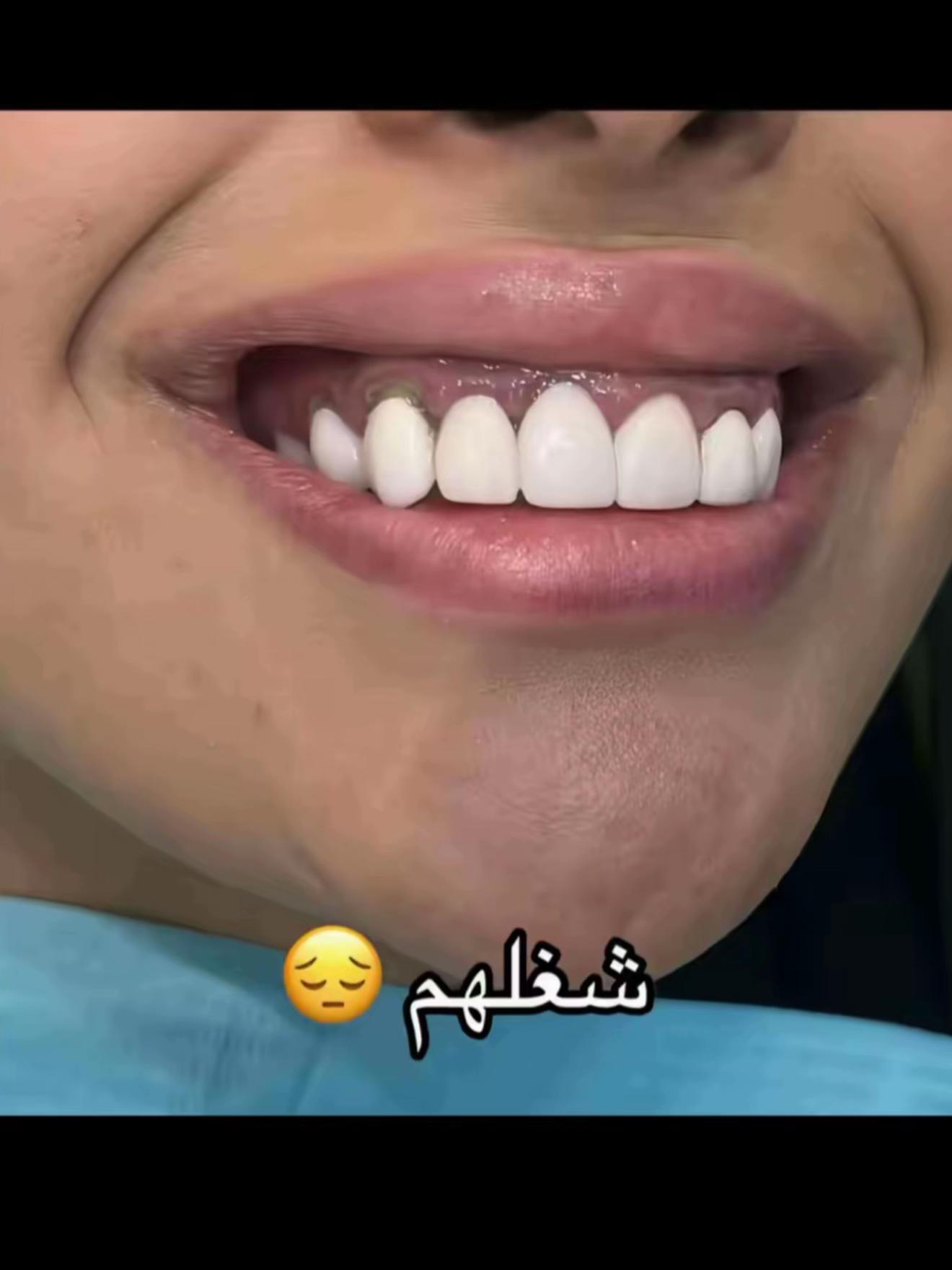 @عيادات بيوتي كورنر