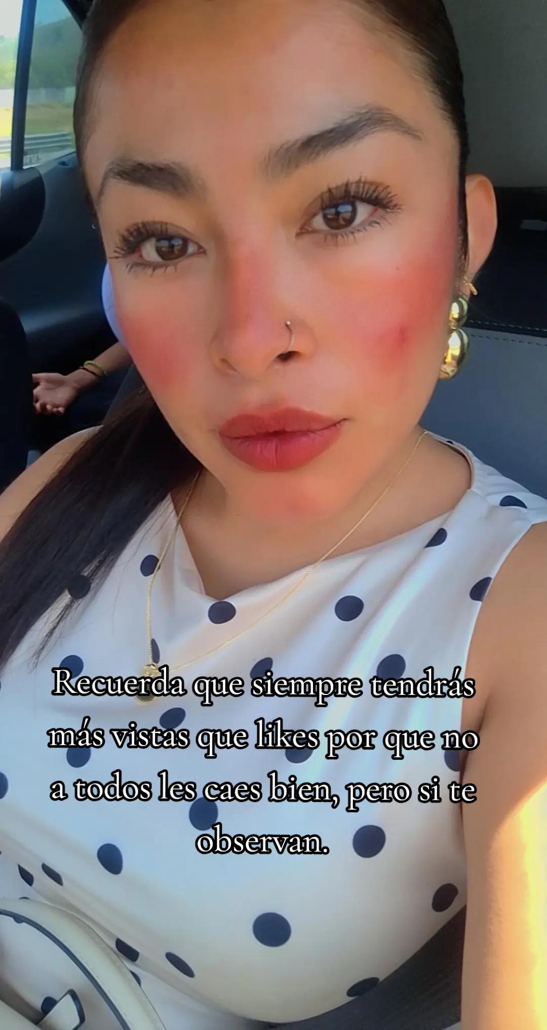 @Aketzali CM