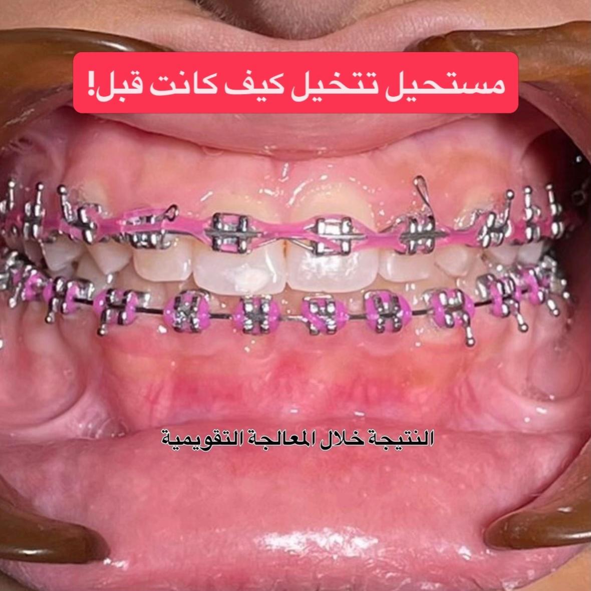 @Dr Tayssir Seddik