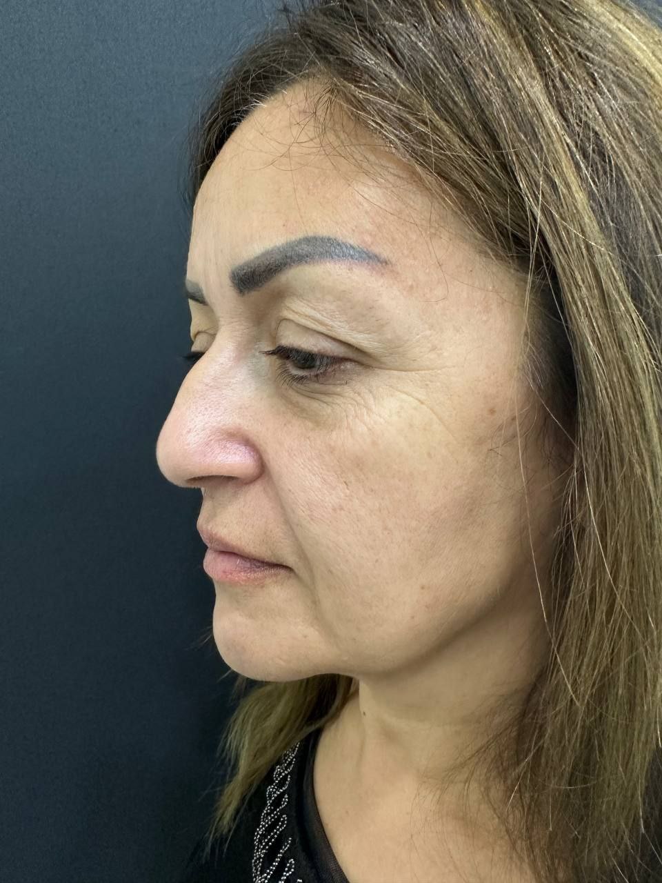 @Lor/Rinoloq/Dr. Şəhla Həsənova