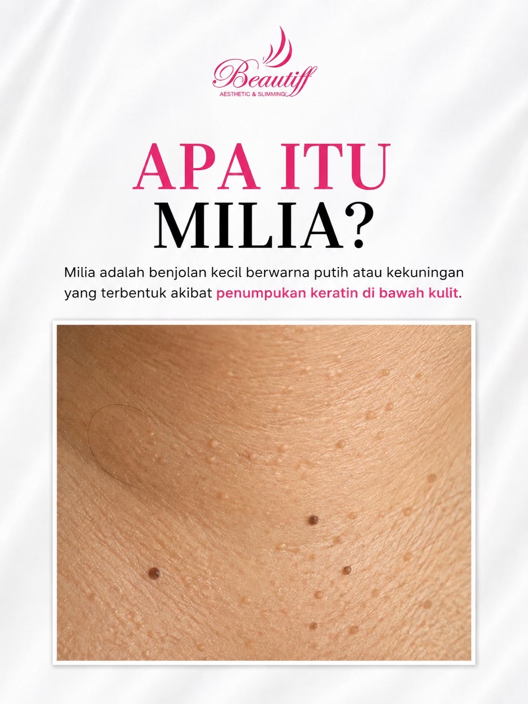 @Beautiff Clinic