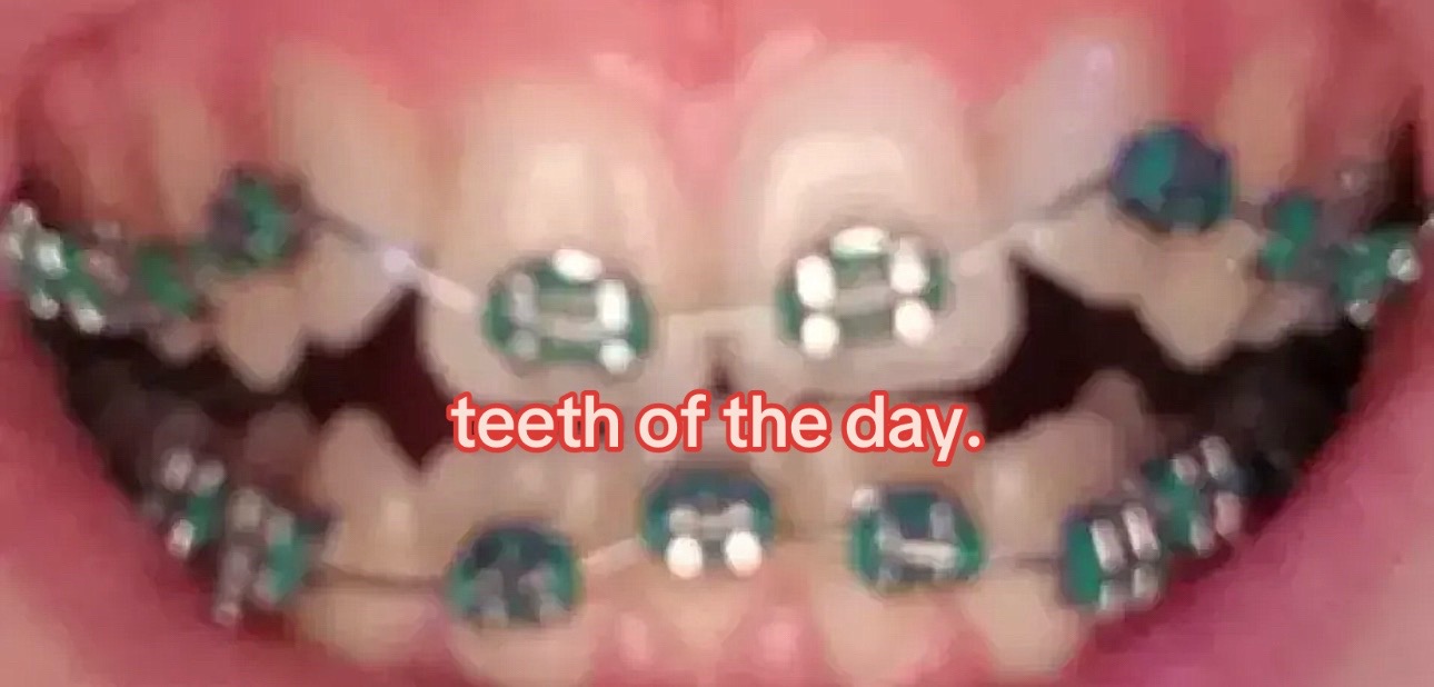 @I leik teeth moer thna mysefl.