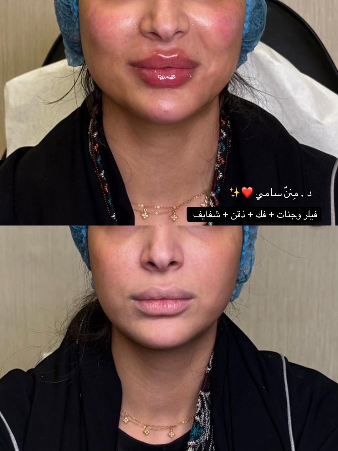 @مركز مزدانه 1 ( فرع الصحافه )
