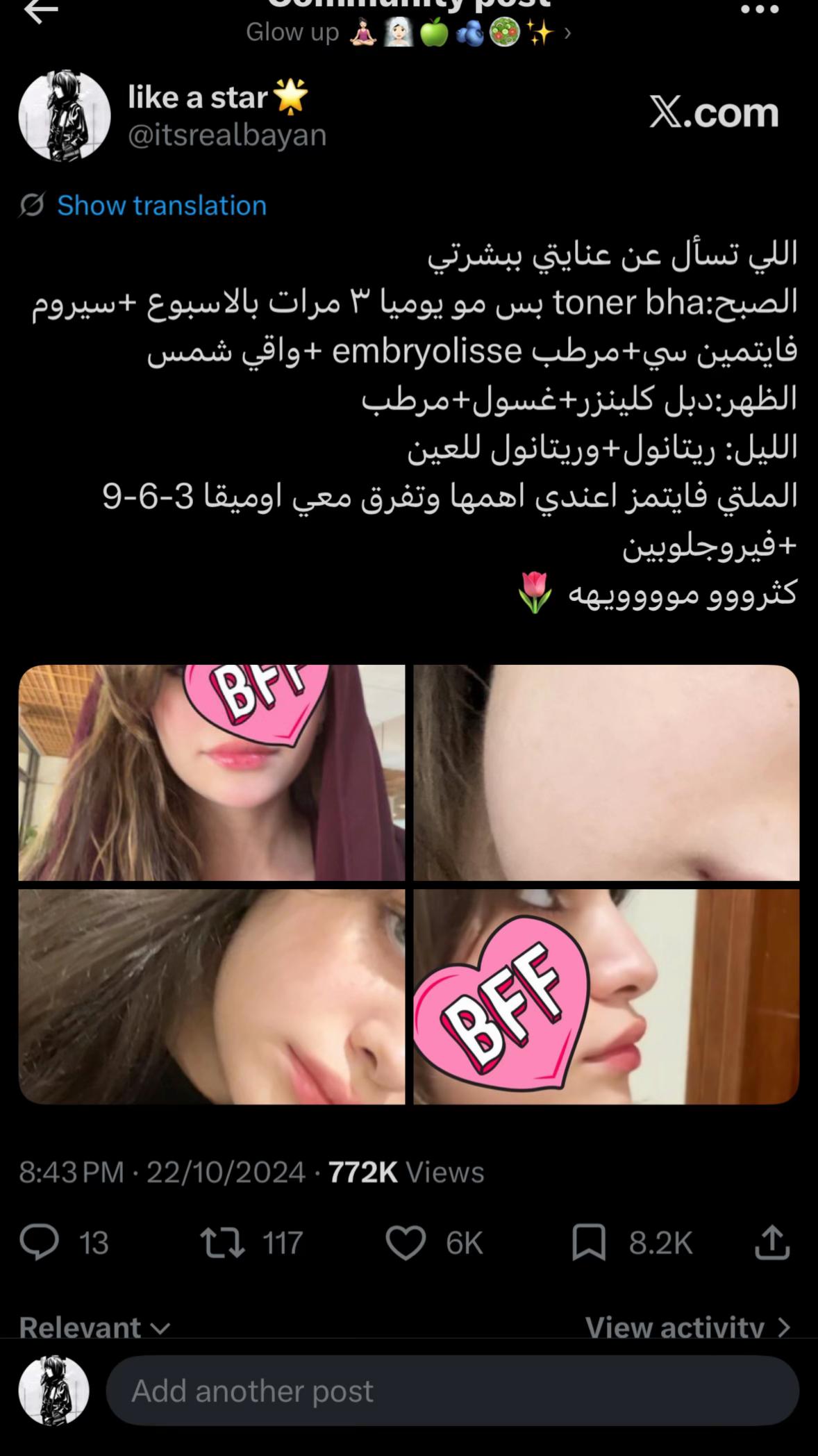 @Like a star ๐