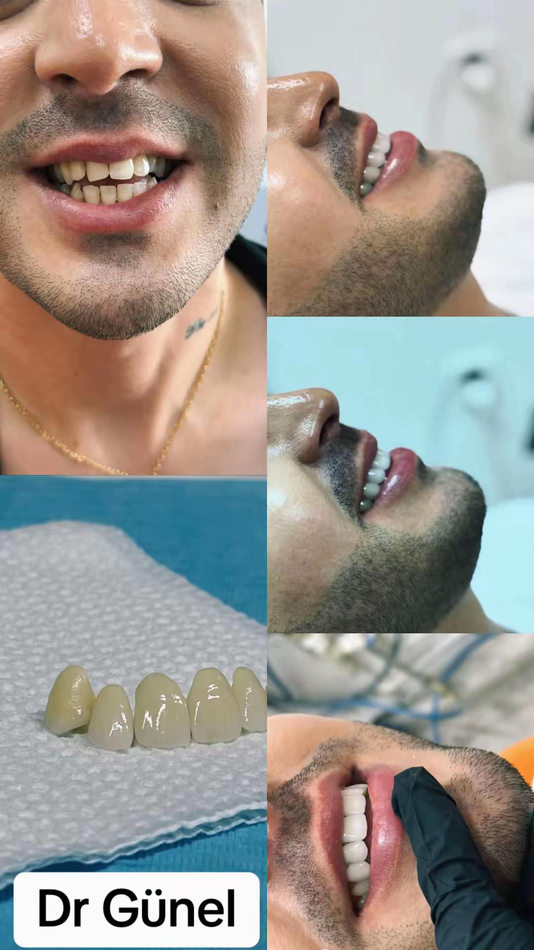@Dentist_Günel