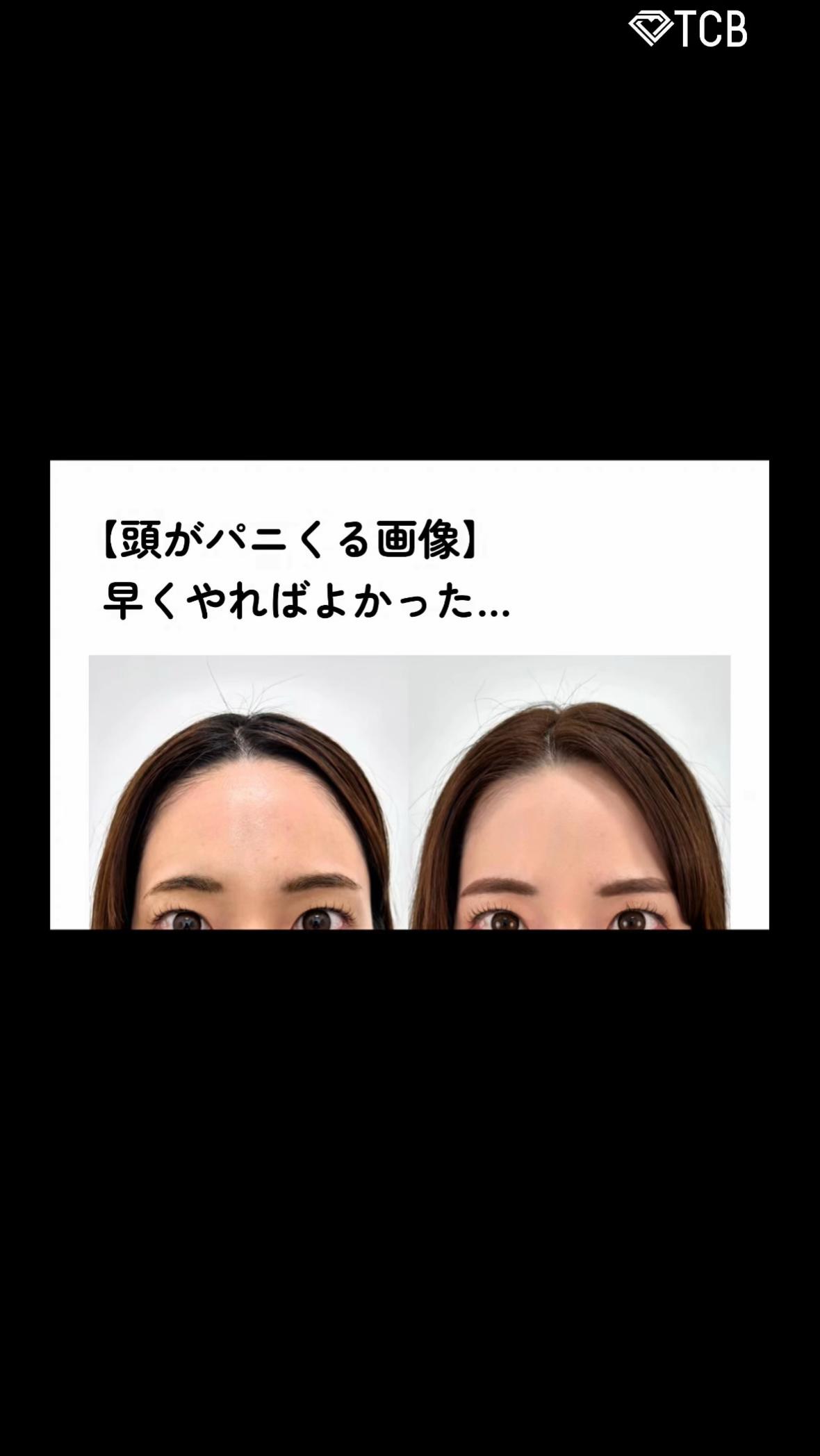 @【クマ取り/小顔整形】TCB京都駅前院 院長 橋本晋太朗