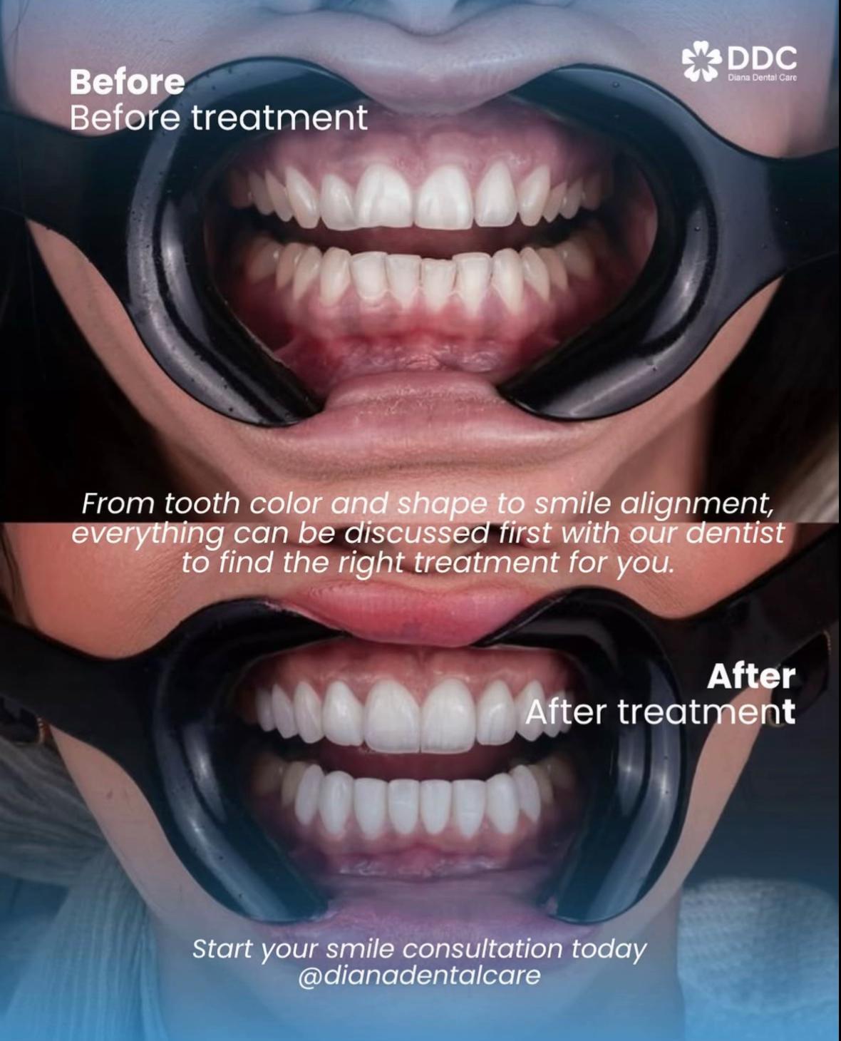@Diana Dental Care