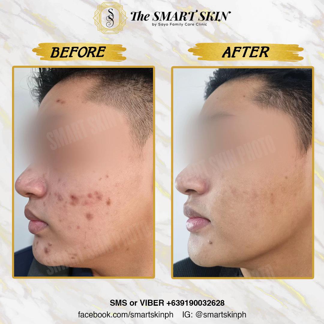@The Smart Skin- Malolos