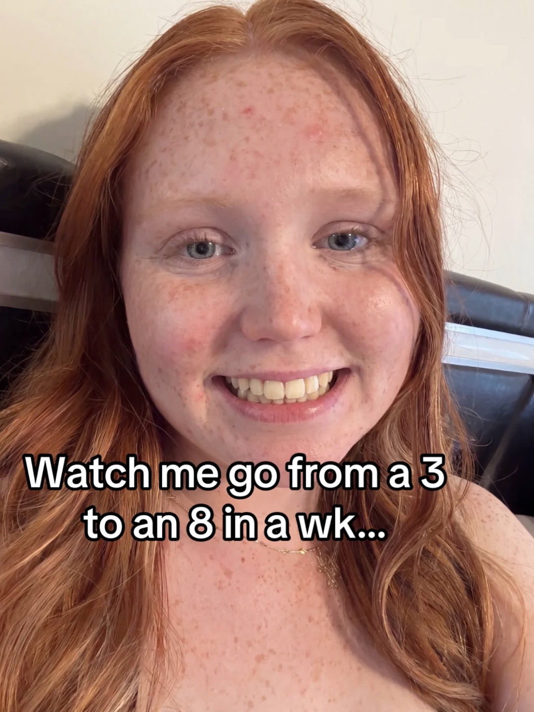 @A