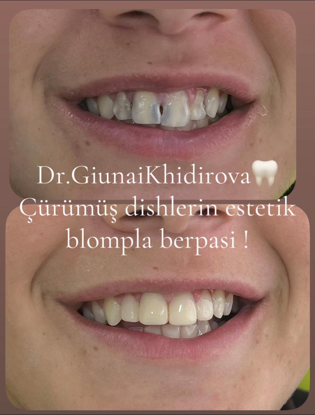 @Dr.Гюнай