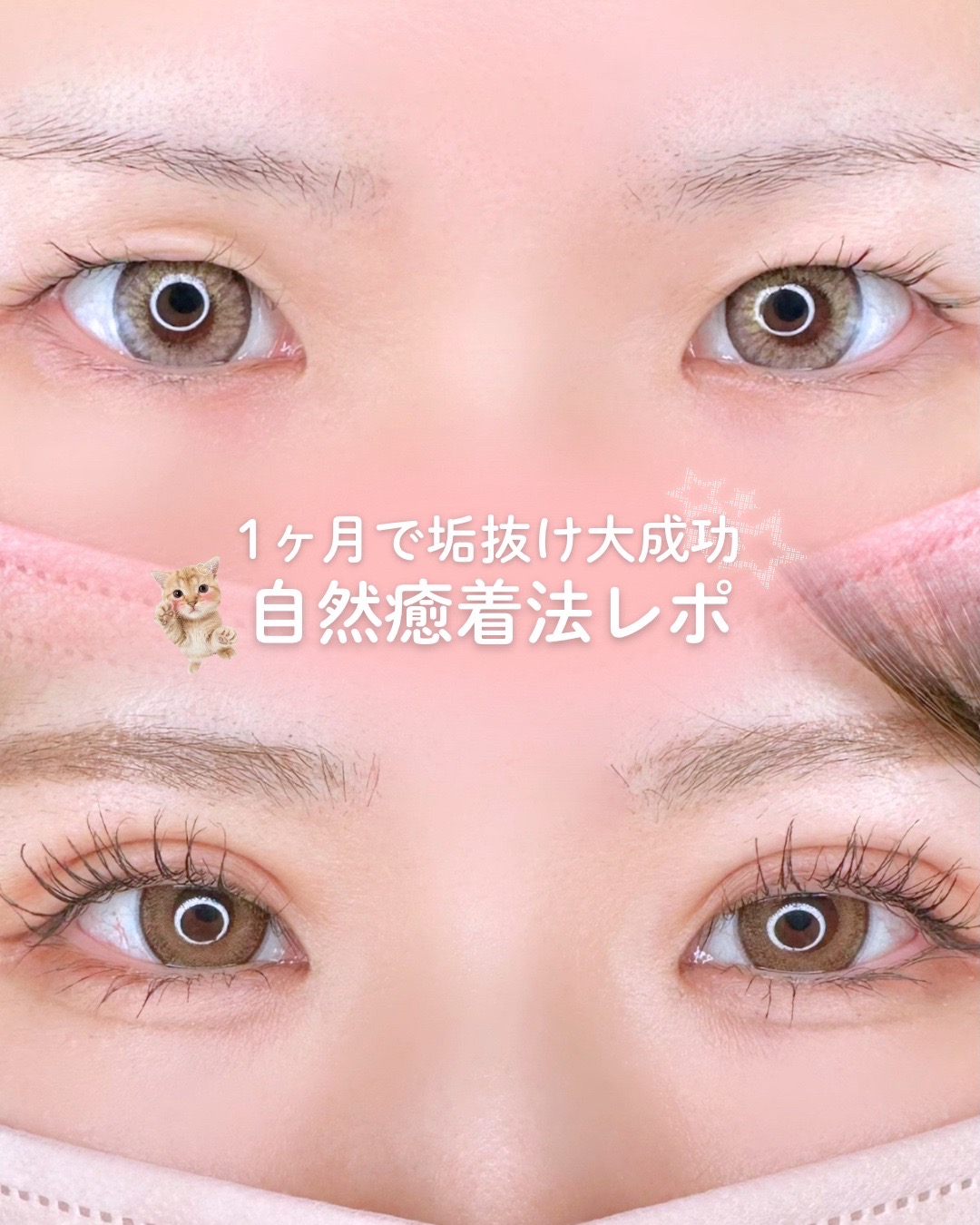 @ルラ美容クリニック大阪本院