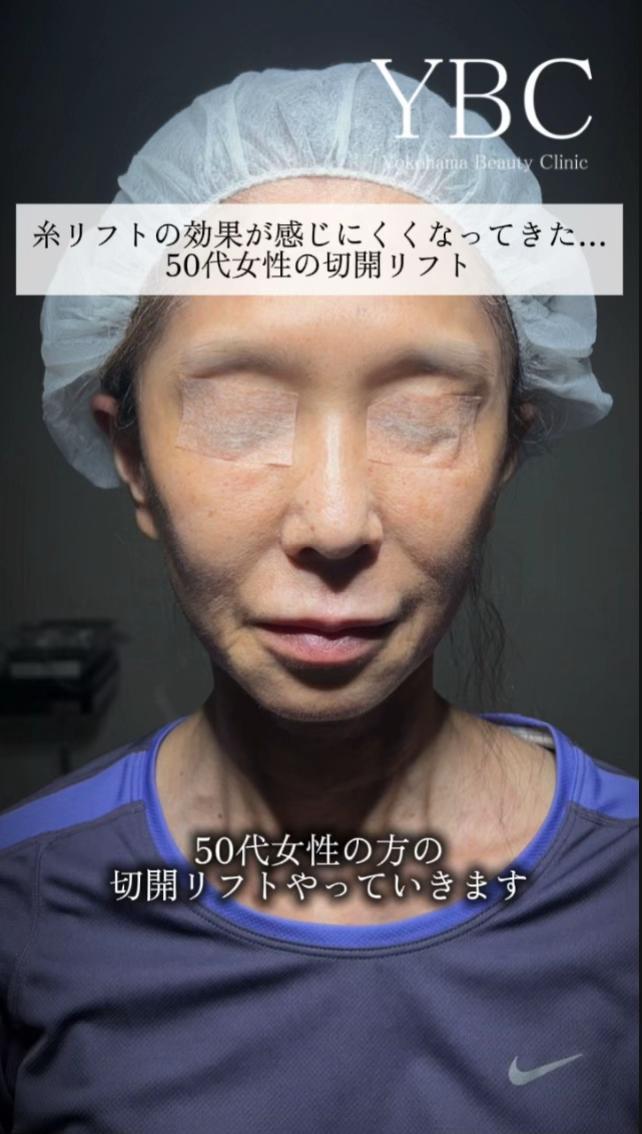 @イソセン/美容外科医（磯村亮輔院長）
