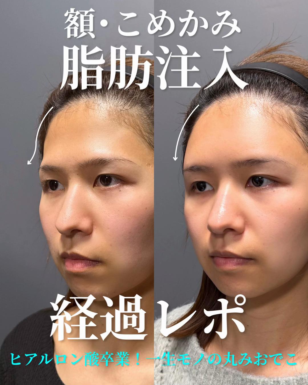 @金澤紀臣【小顔/若返り/脂肪吸引】