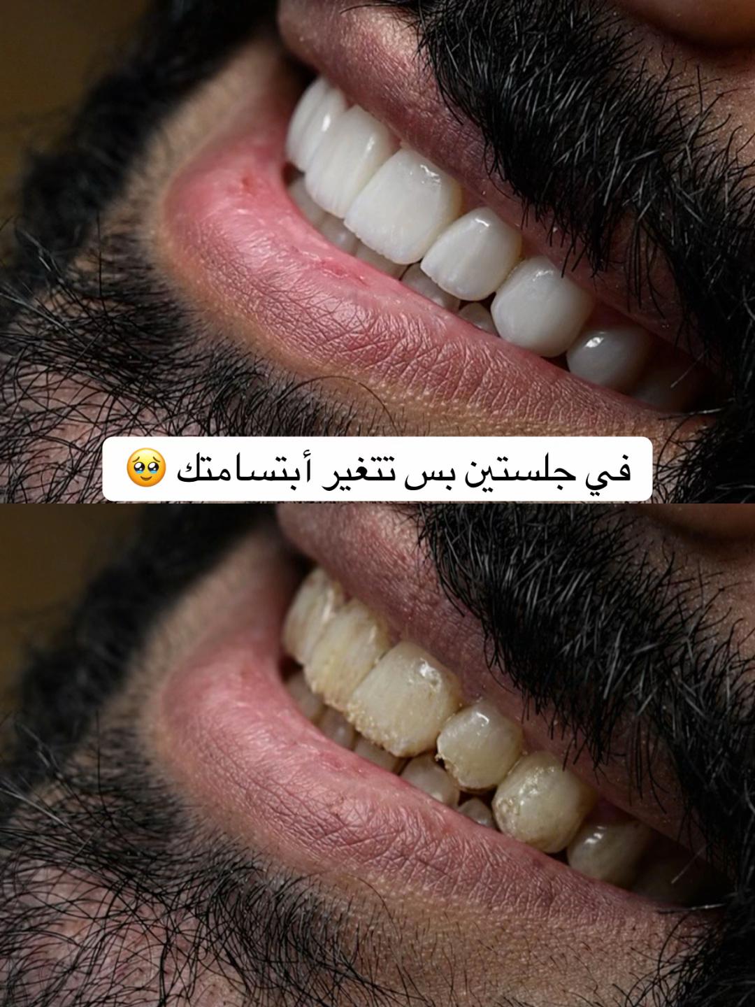 @Dr.ranaalsilani
