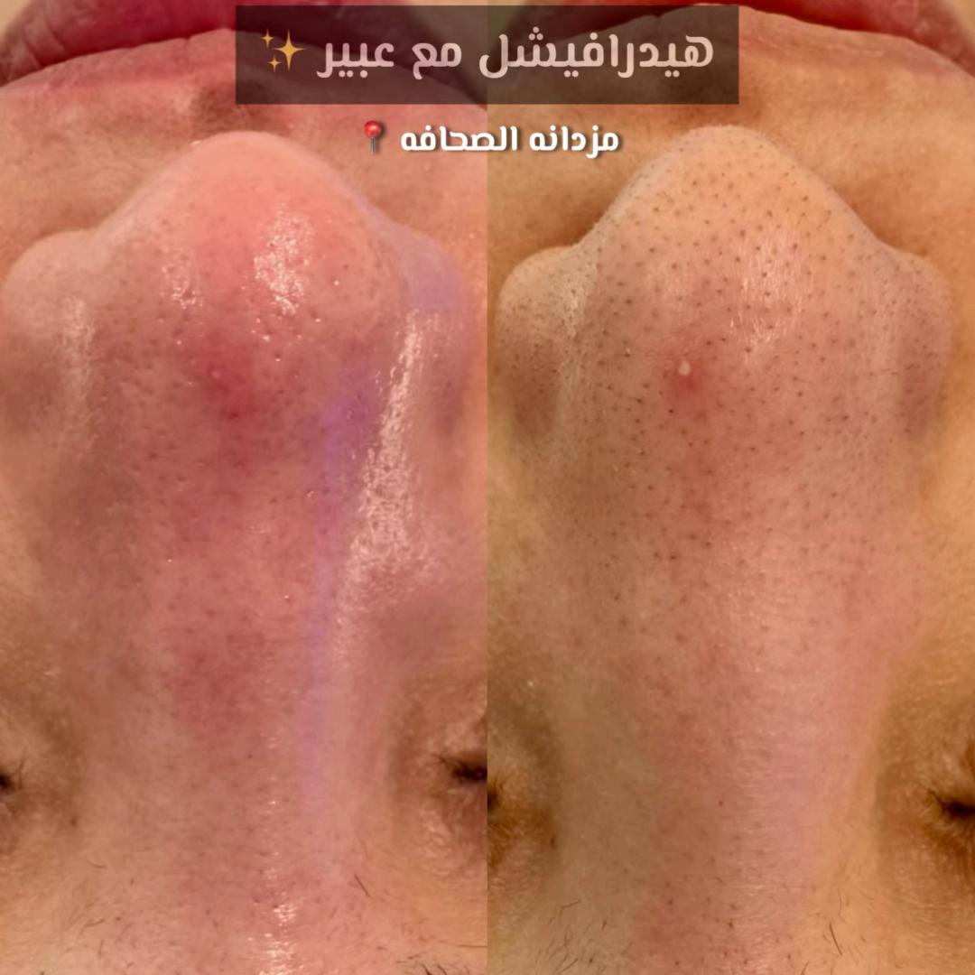 @مركز مزدانه 1 ( فرع الصحافه )
