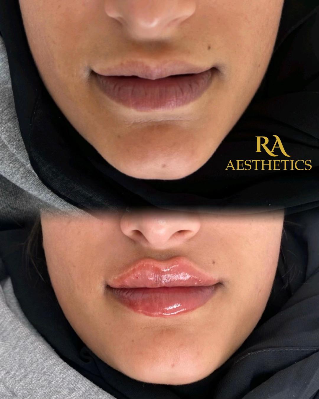 @Ra_Aesthetics_sheffield