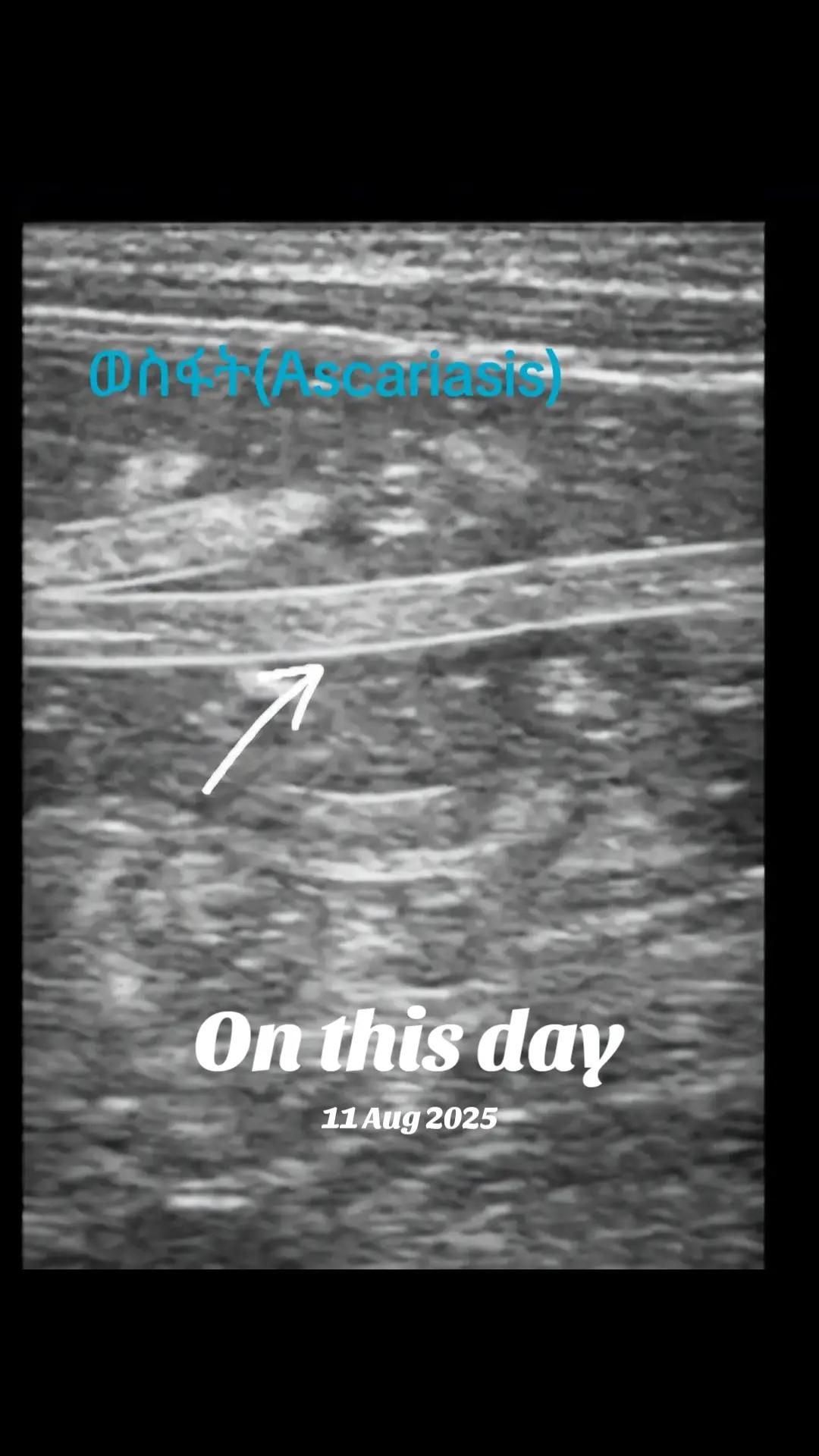 @Dr Wubie Endalew(Radiologist)
