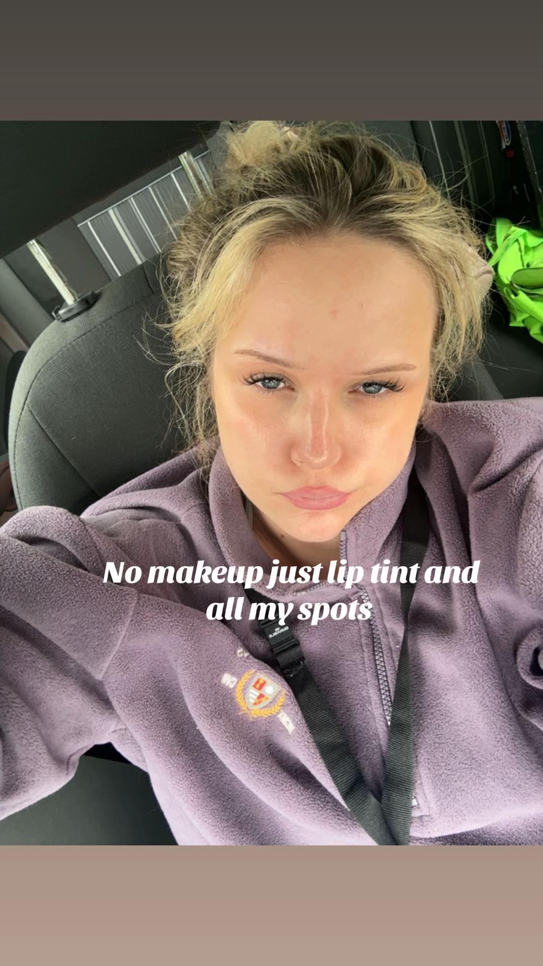 @Juste