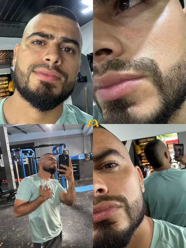 @Nacho cárdenas