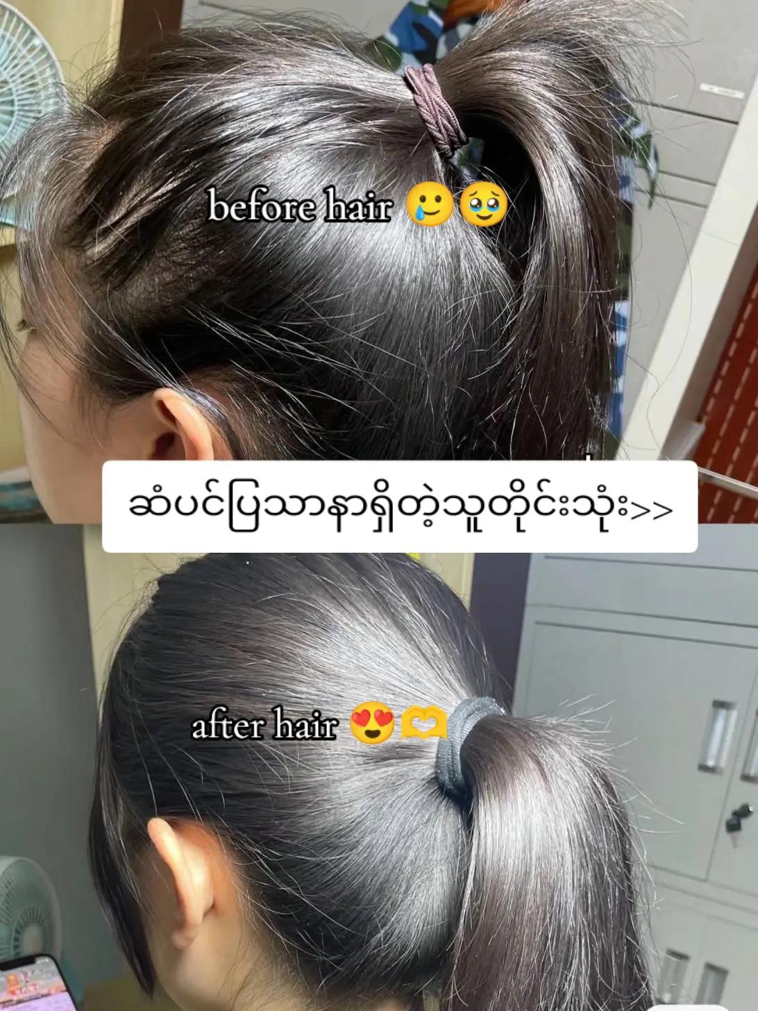 @Yadanar Linn