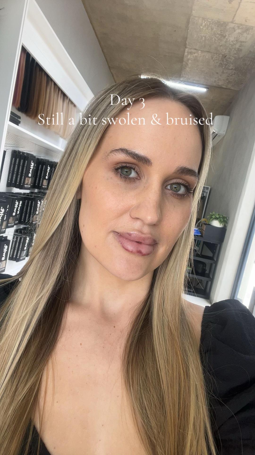 @Simonevanwyk