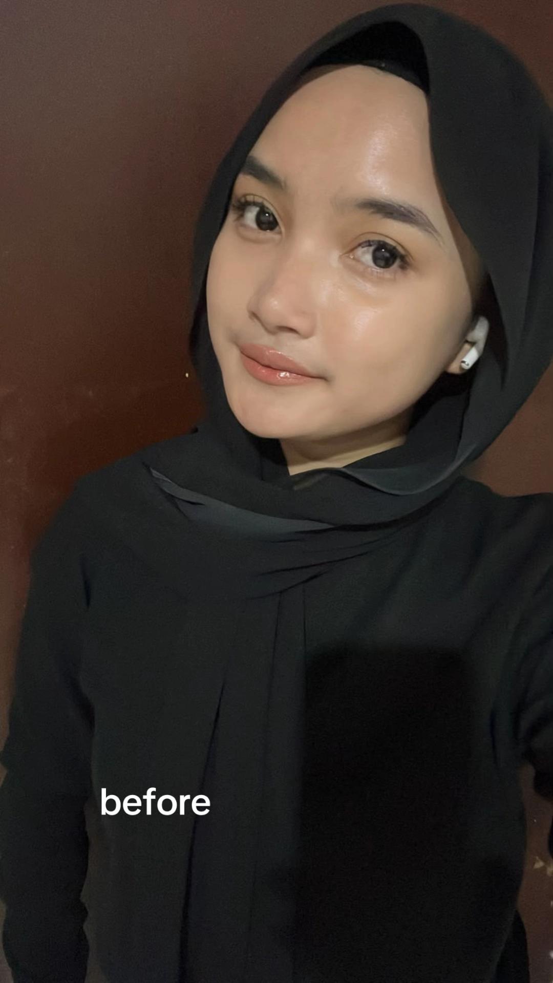 @Rr. Athaya