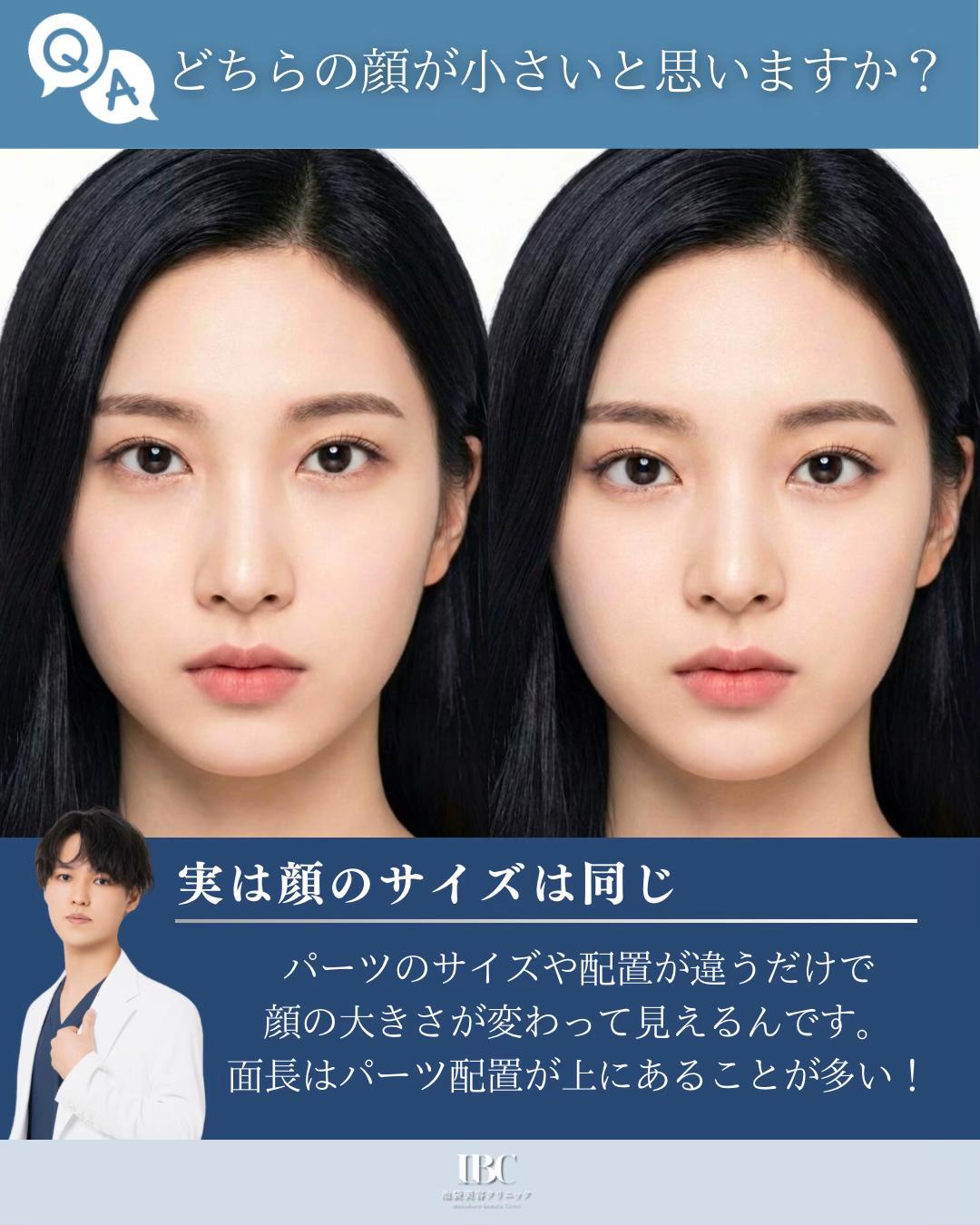 @高倉光平【タレ目形成×目尻切開】