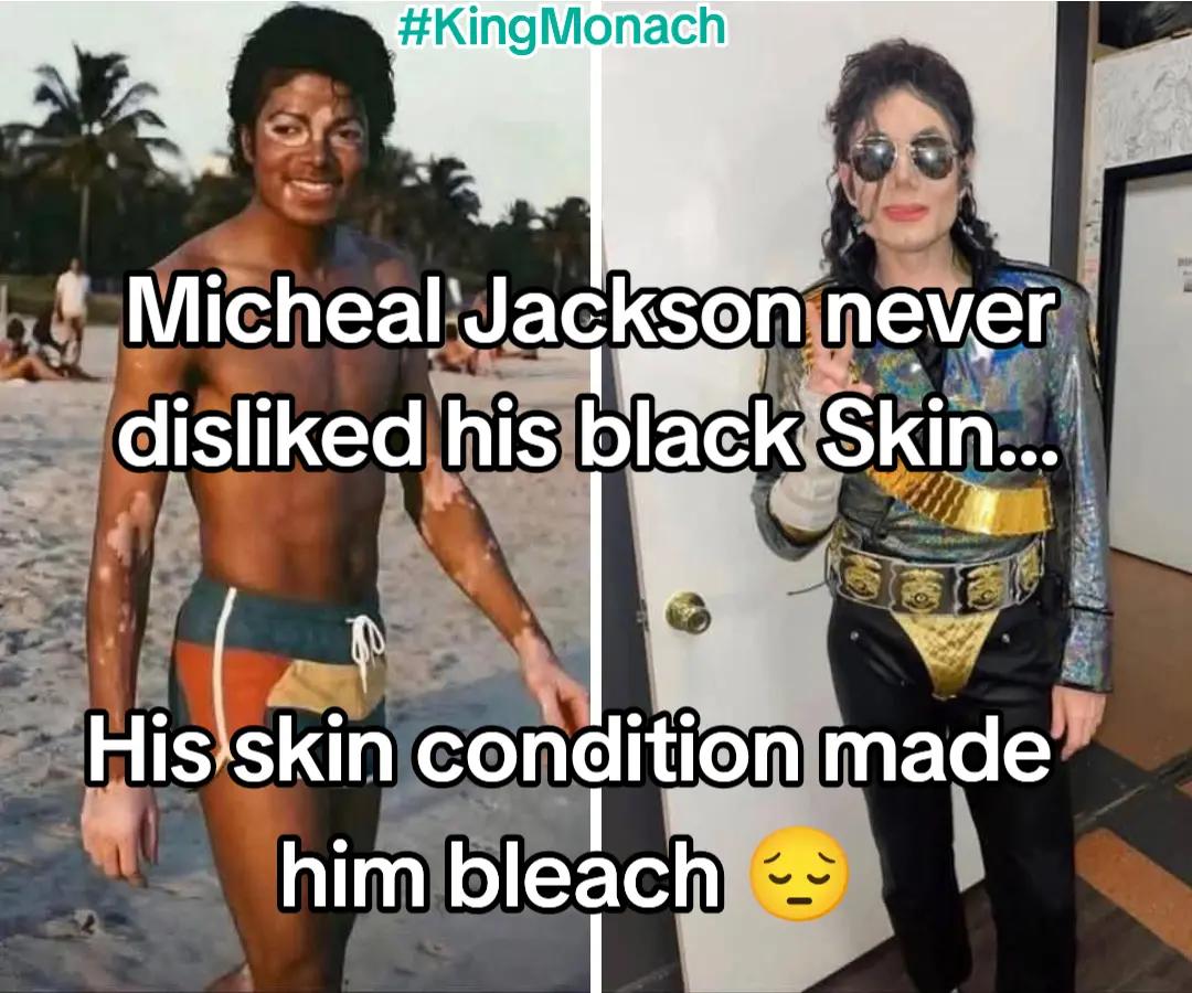 @KingMo Nach