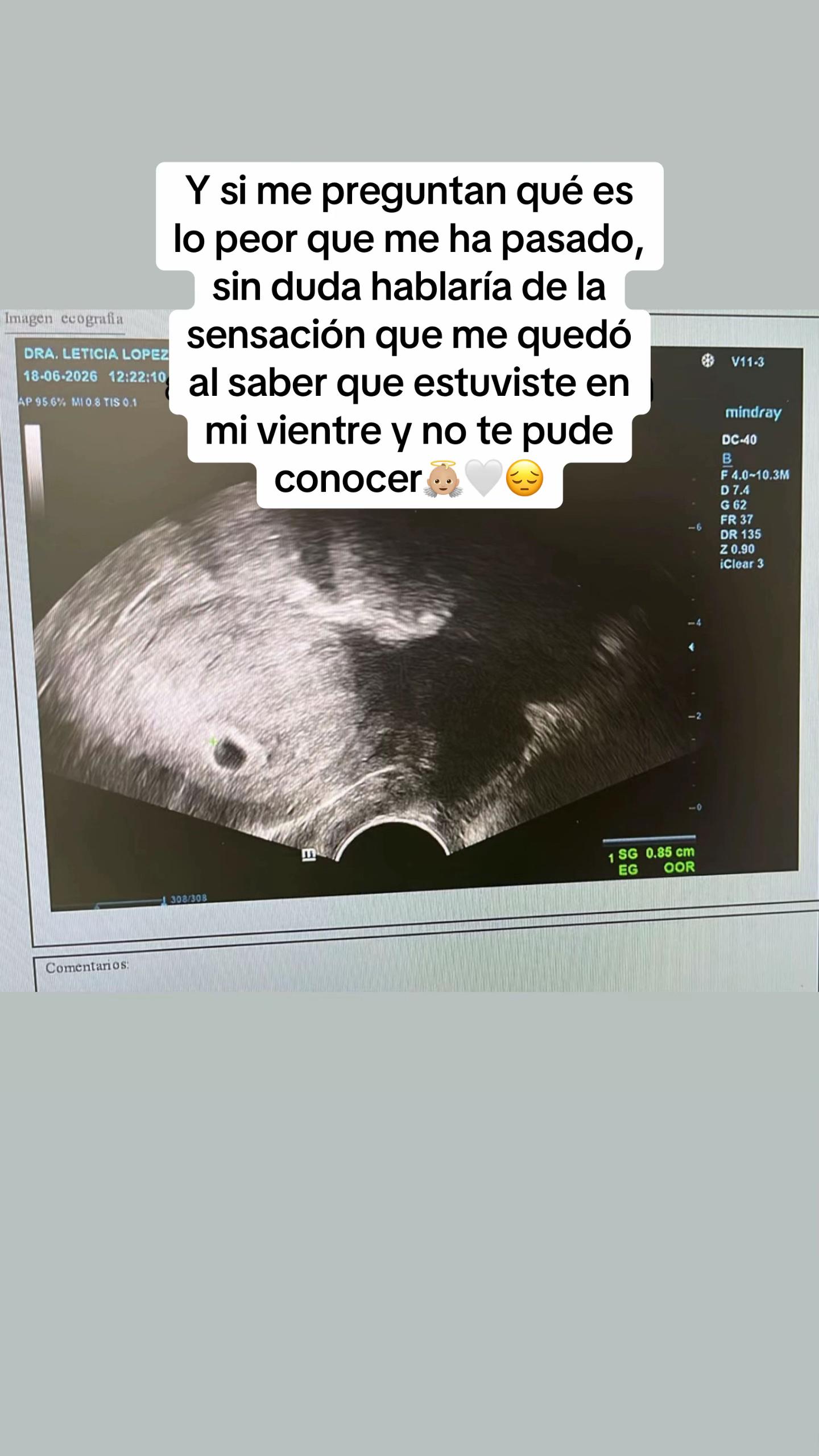@BereniceeHS7