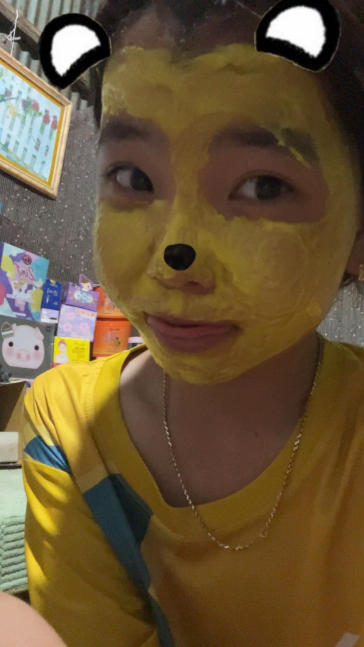 @Mi Kmab ๐ท