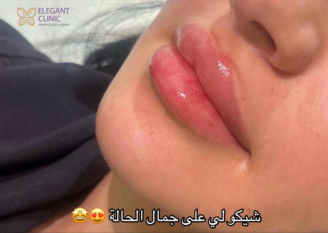 @Elegant Clinic | عيادات اليقنت