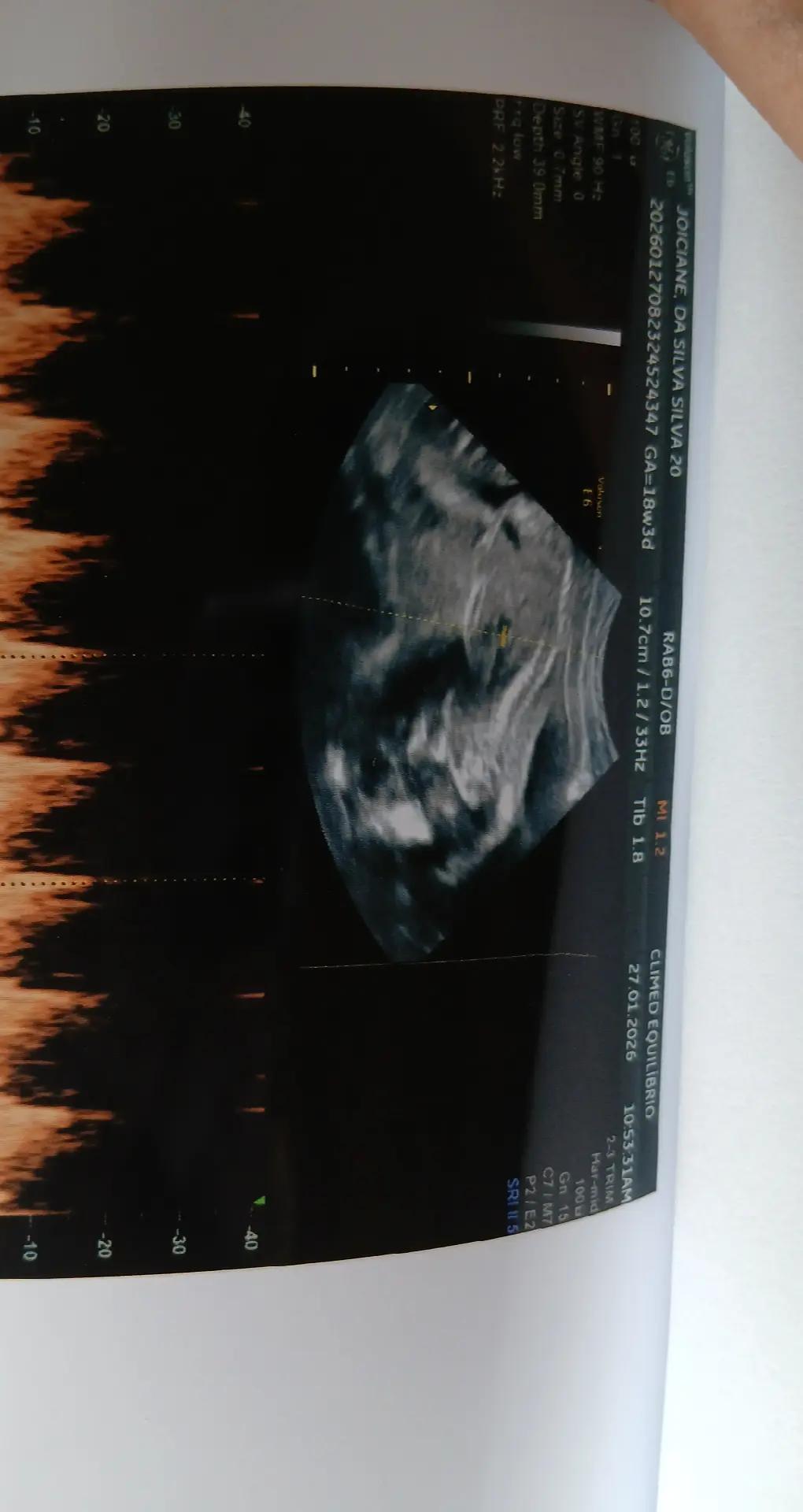 @Joiciane mãe de três 💖👼🤰