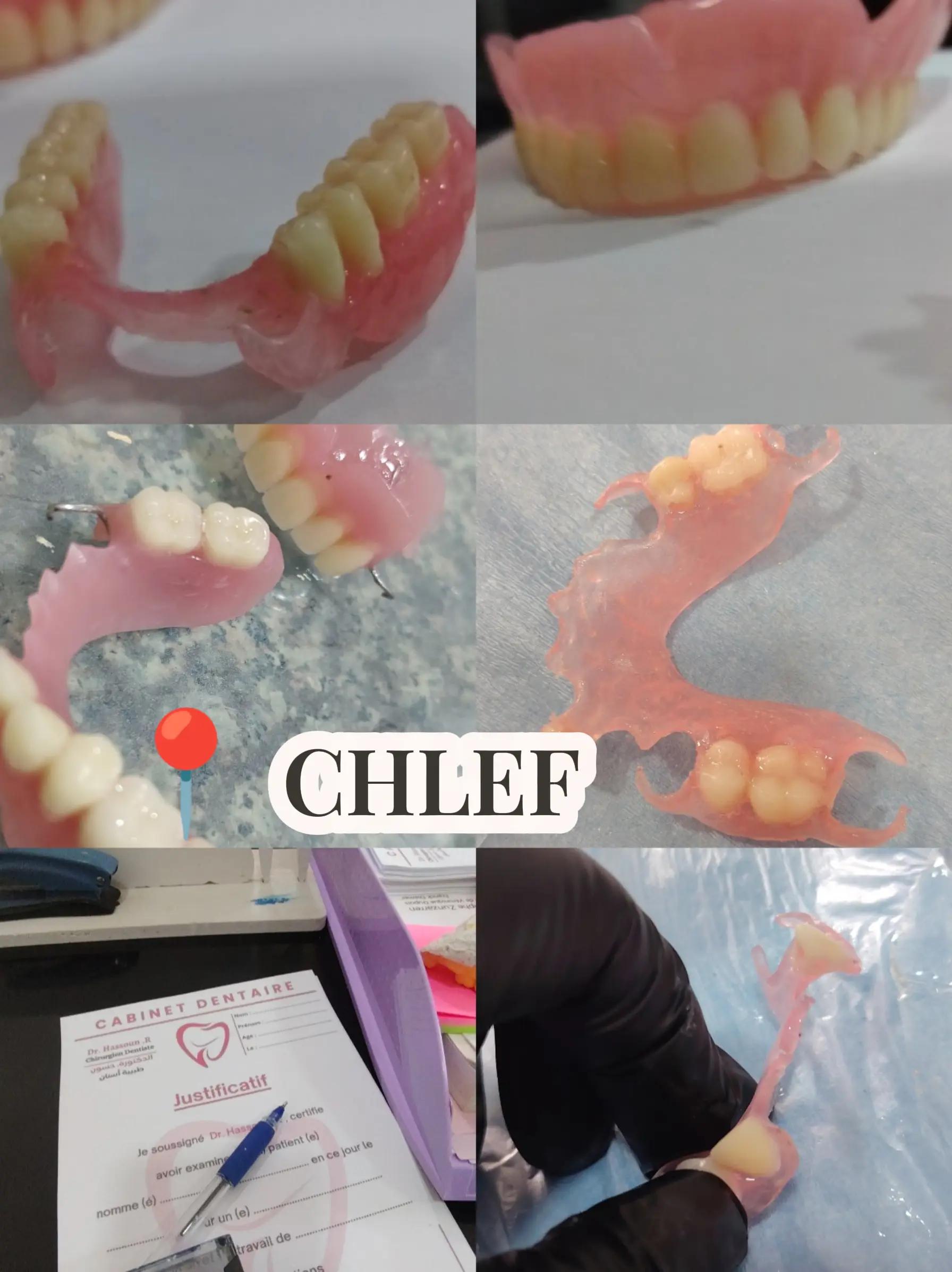 @Dr HASSOUN02 طبيبة الاسنان شلف