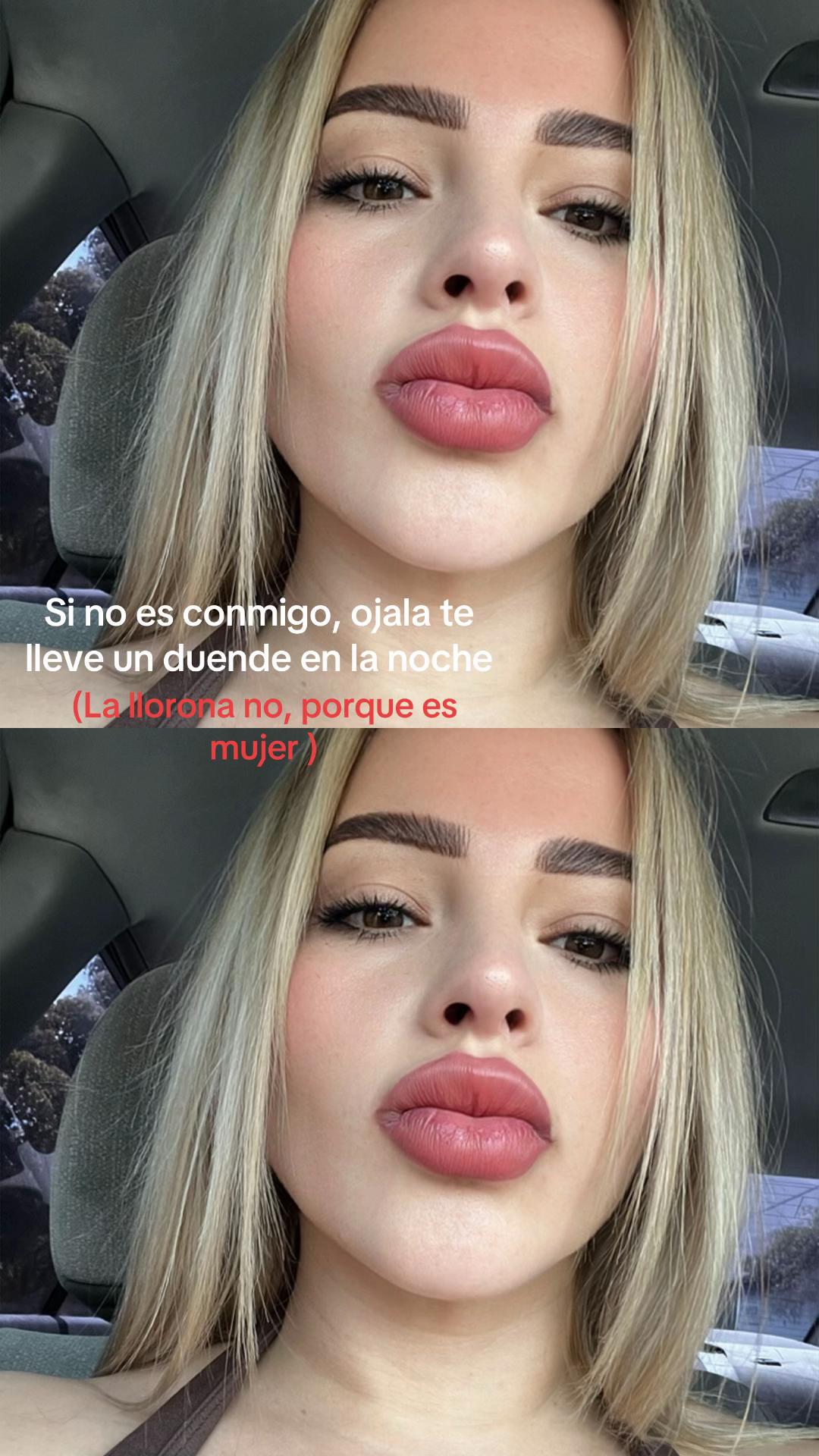 @Arlin González🍀