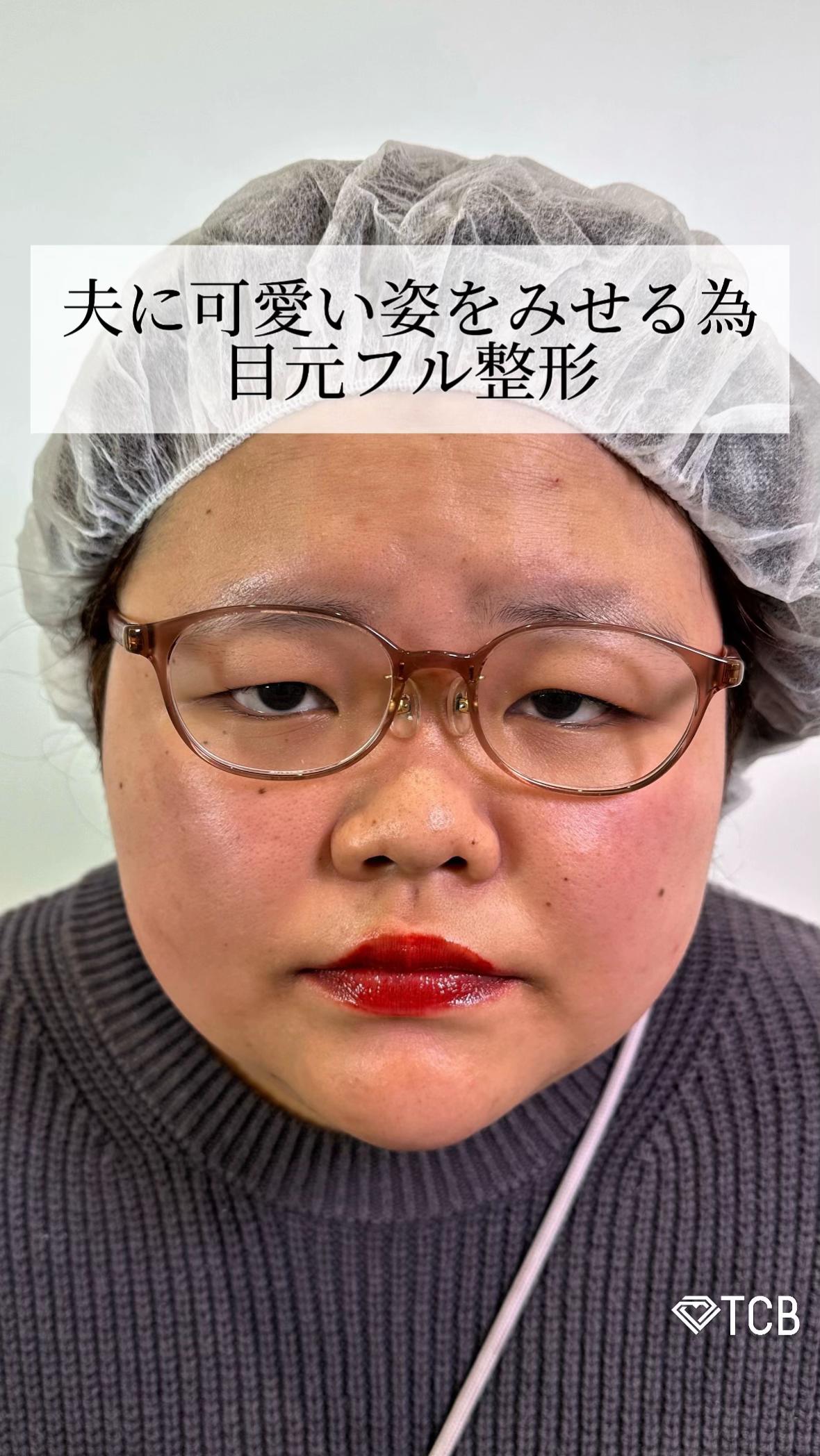 @【二重整形】TCB 新宿東口院ゆいこ先生/東京