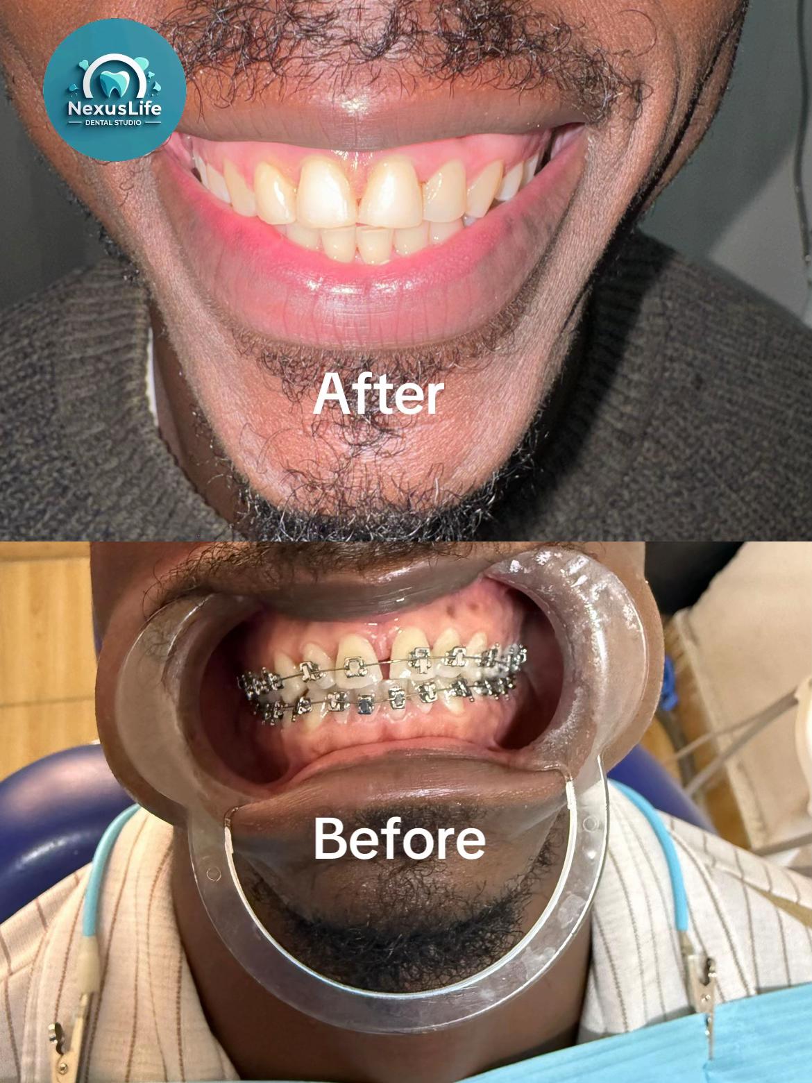 @NEXUSLIFE DENTAL CLINIC🦷
