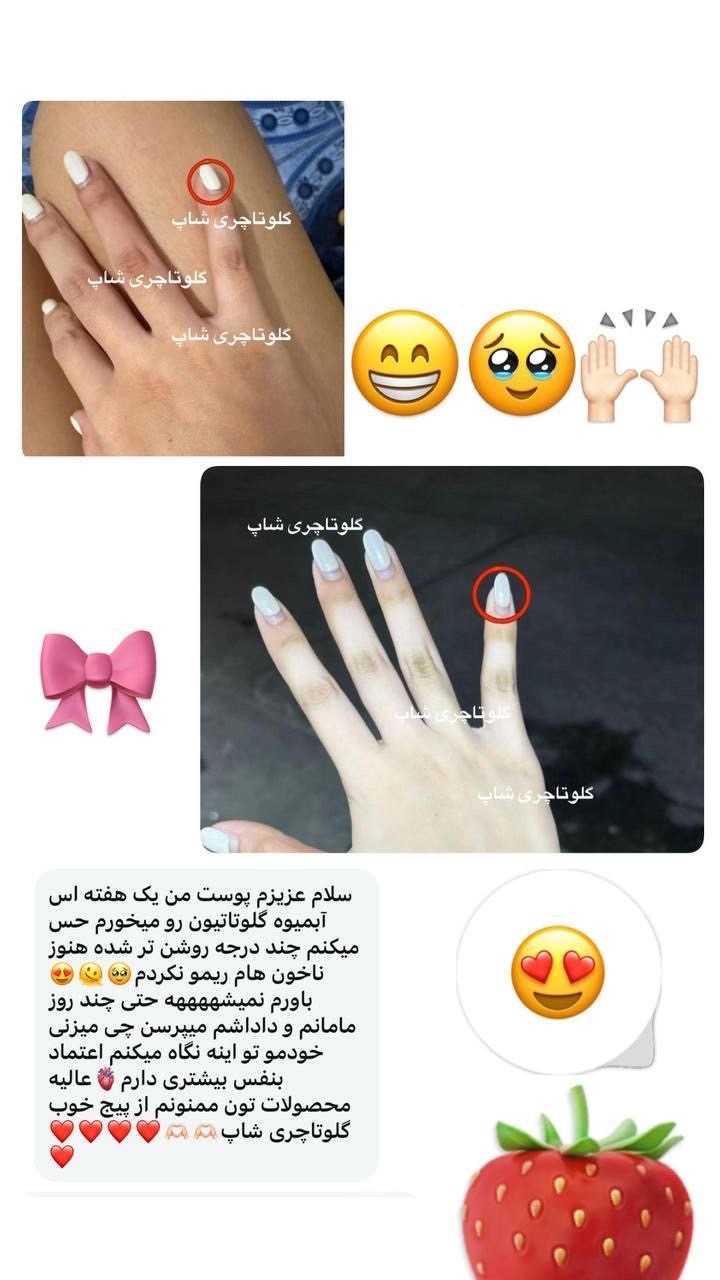@گلوتاچری شاپ