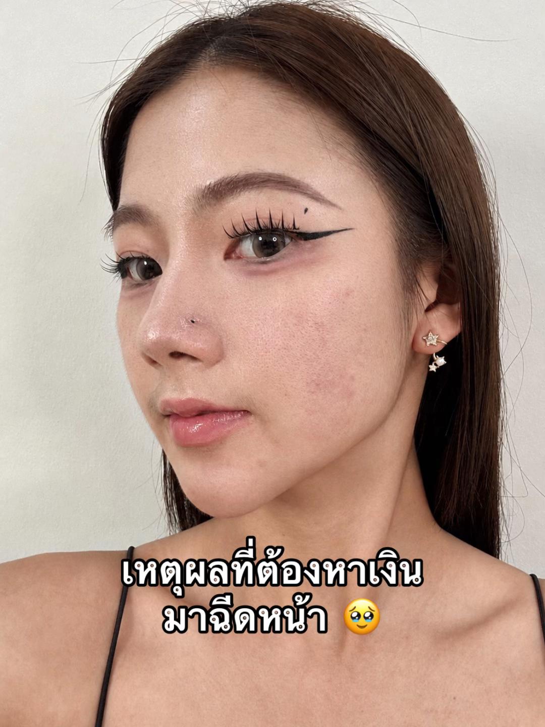 @APEXYOUNGCLINIC