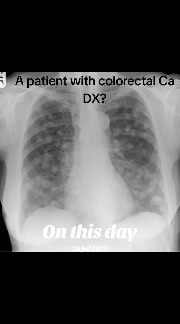@Dr Wubie Endalew(Radiologist)