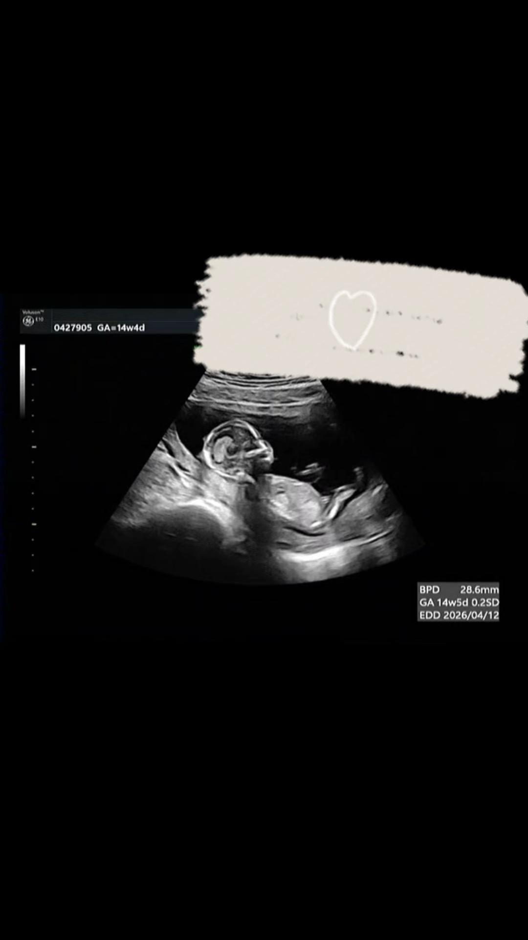 @Baby/WAð¶ð»ðŒ